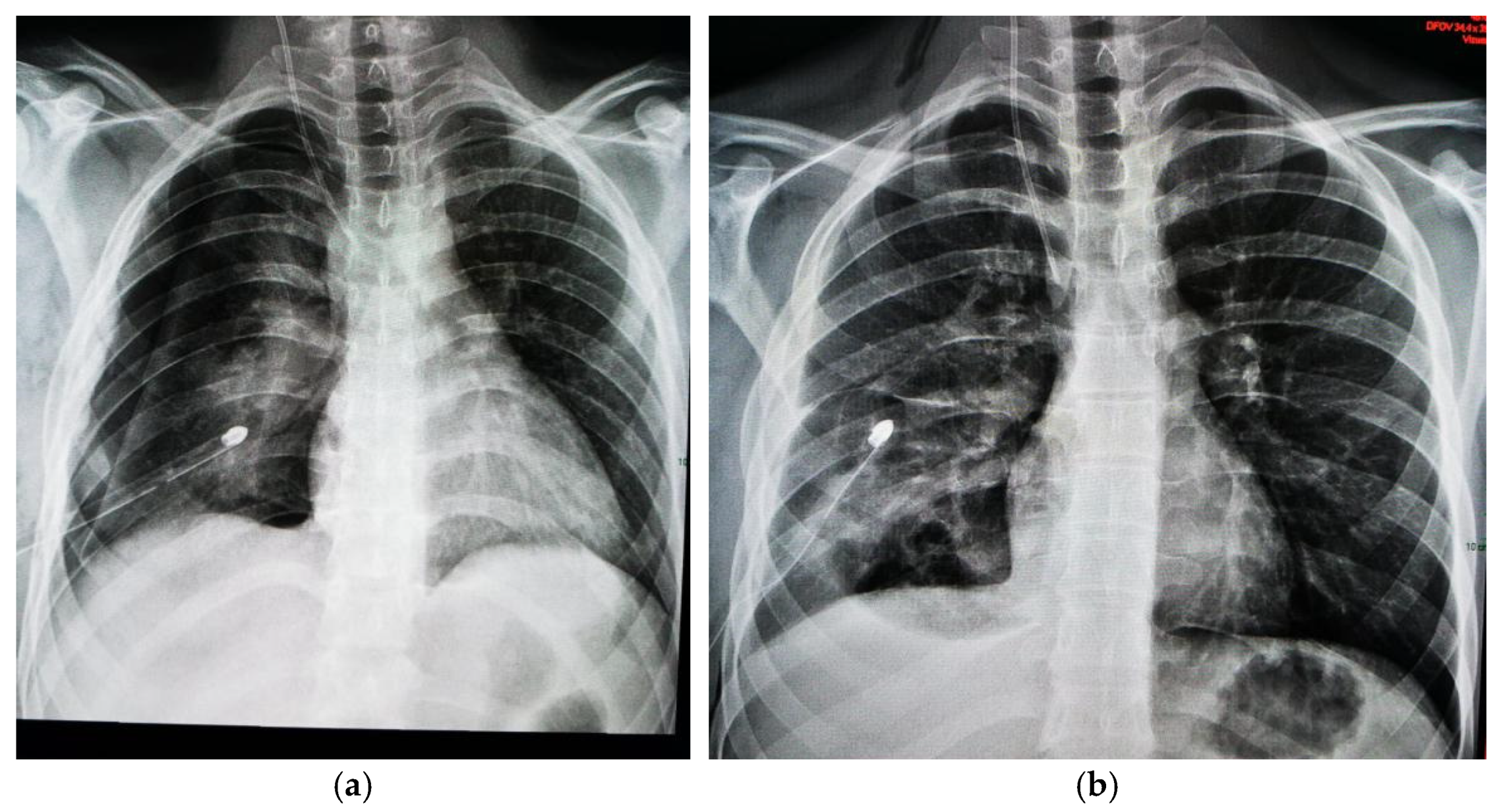 Jcm 13 07790 g009 Jcm 13 07790 g009