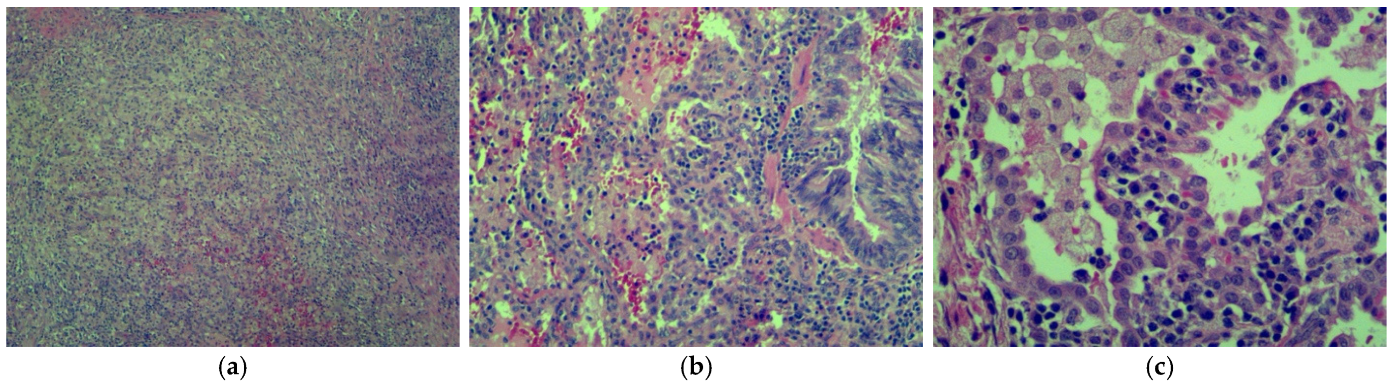 Jcm 13 07790 g010 Jcm 13 07790 g010