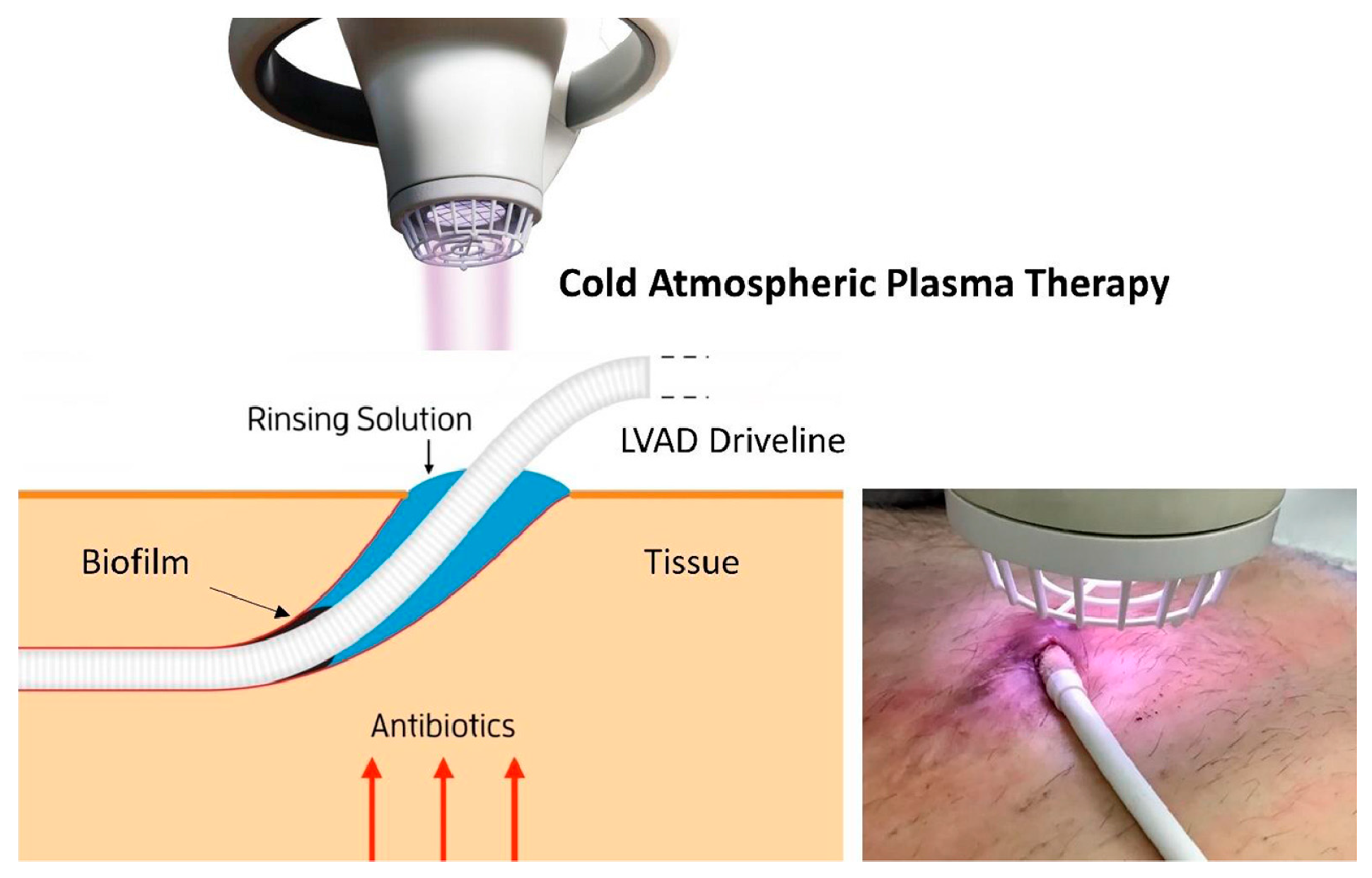 Jcm 13 07813 g001 Jcm 13 07813 g001