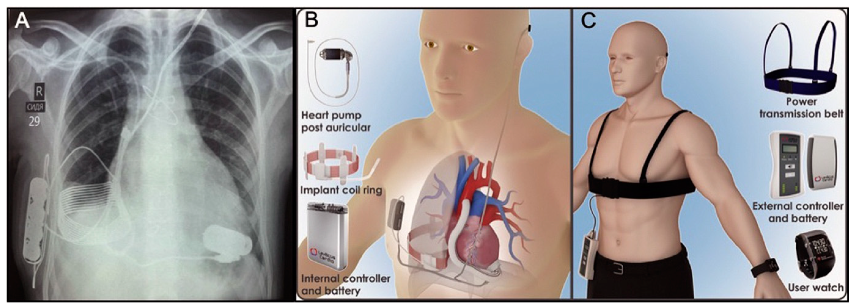 Jcm 13 07813 g002 Jcm 13 07813 g002