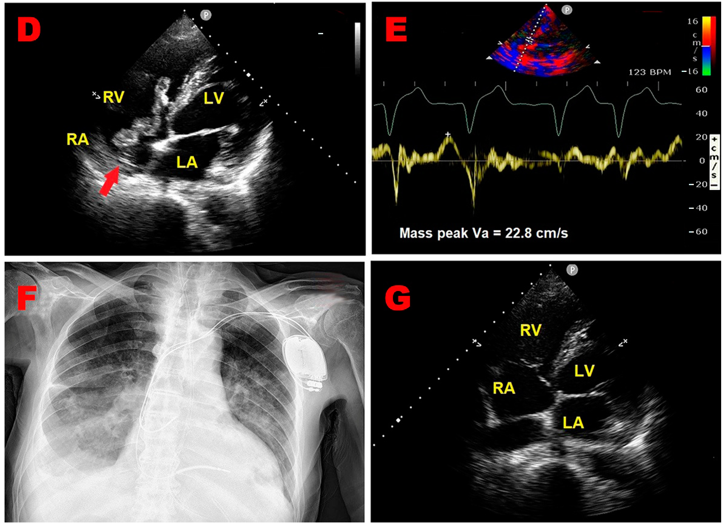 Jcm 14 00086 g001b Jcm 14 00086 g001b