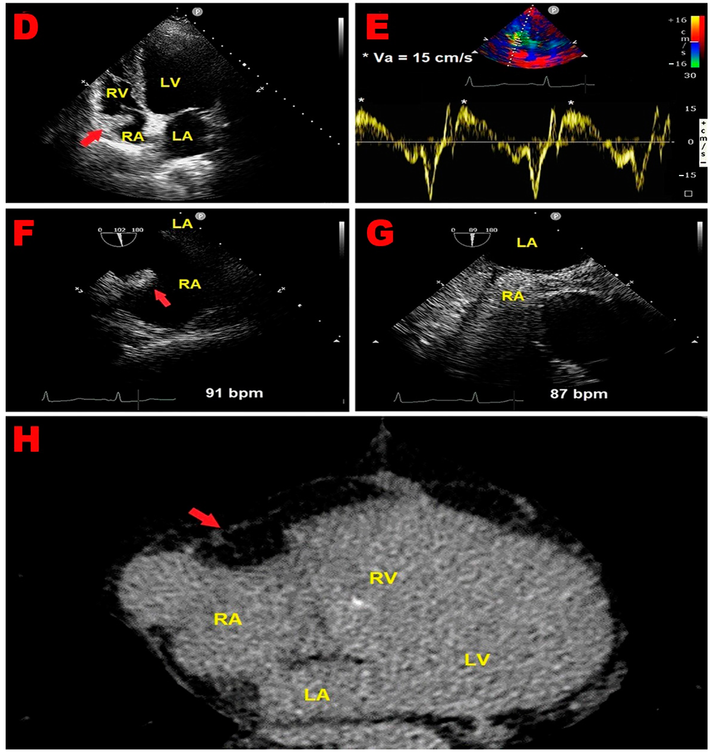 Jcm 14 00086 g002b Jcm 14 00086 g002b
