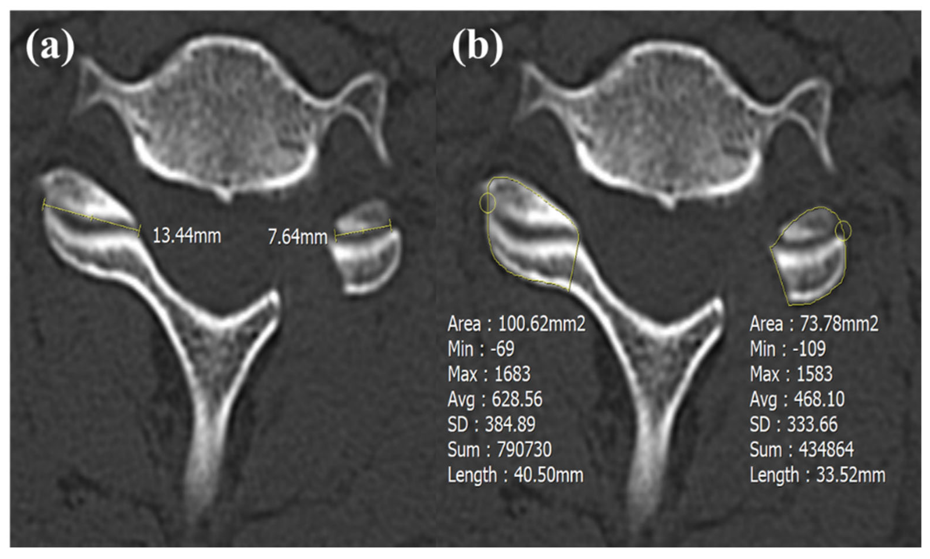 Jcm 14 00164 g003 Jcm 14 00164 g003
