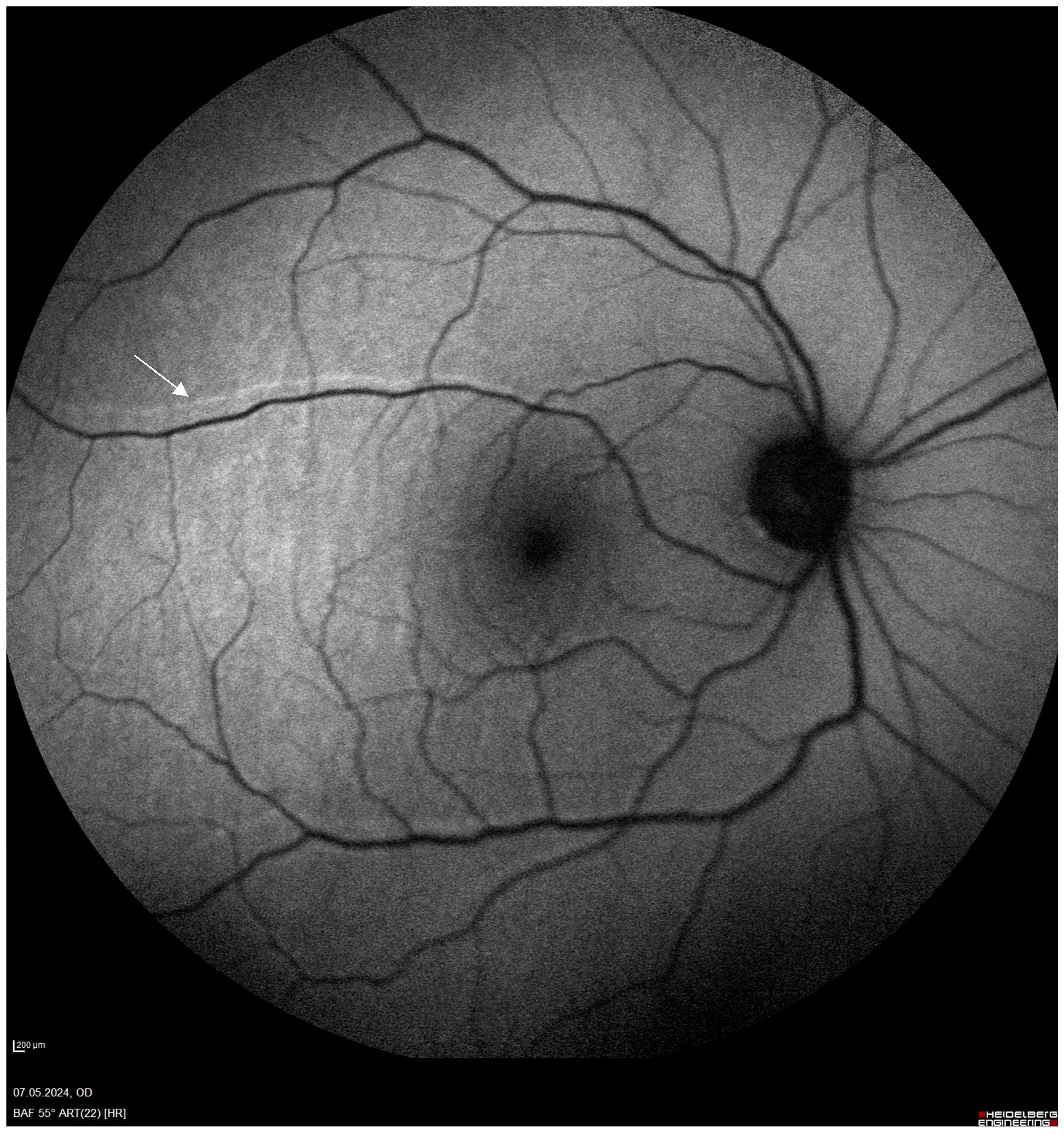 Jcm 14 00250 g001 Jcm 14 00250 g001