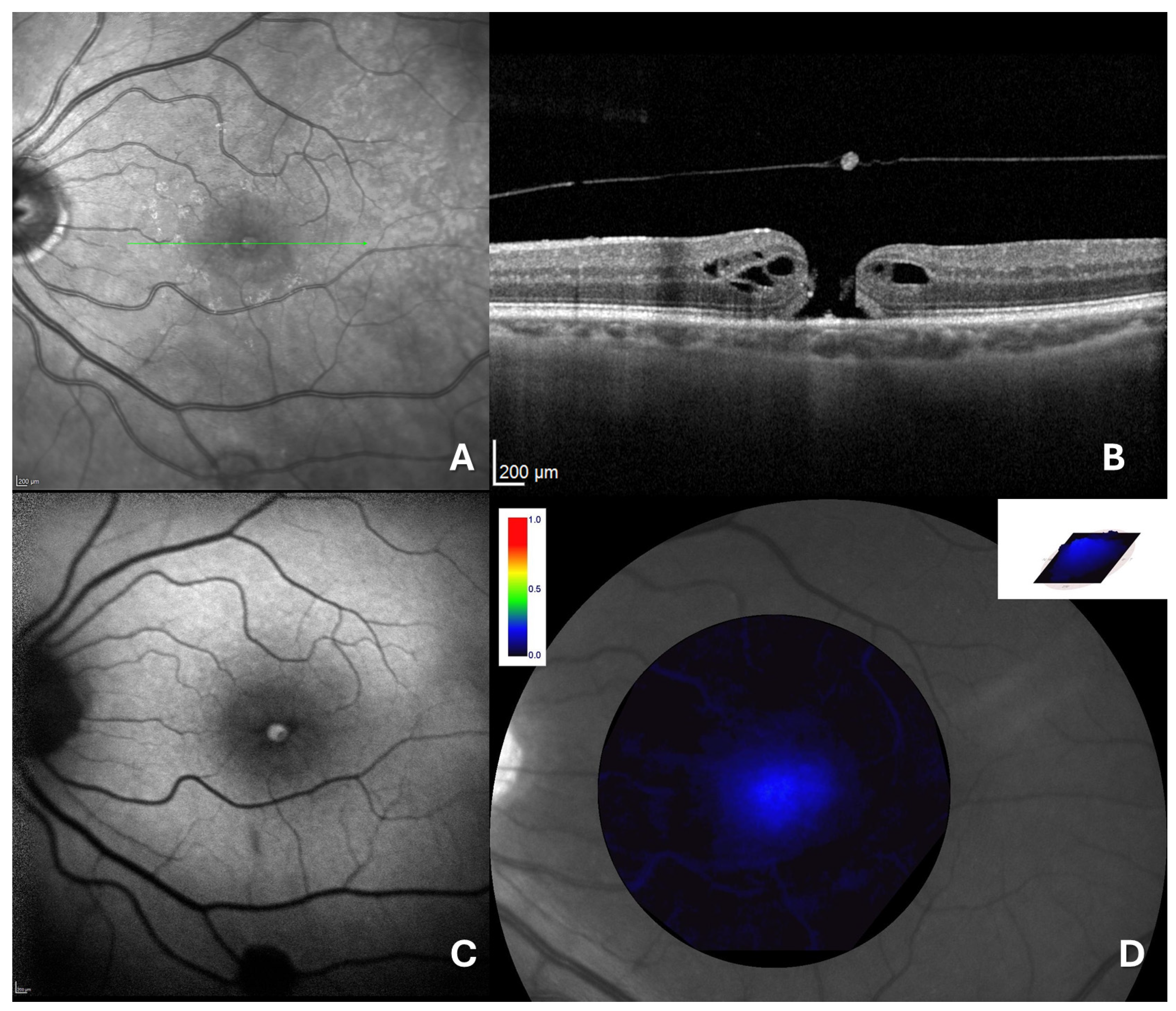 Jcm 14 00290 g002 Jcm 14 00290 g002