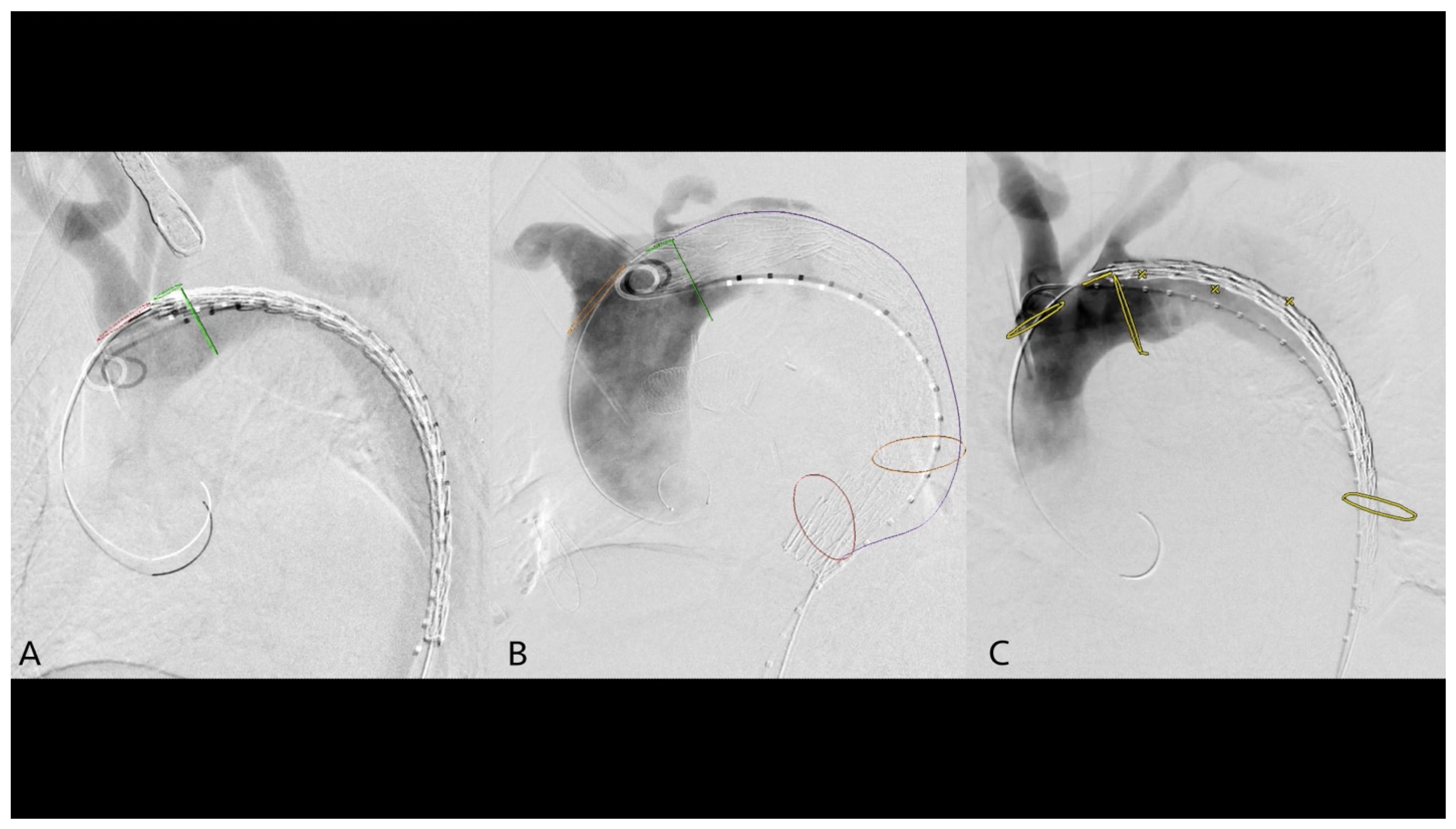 Jcm 14 00301 g002 Jcm 14 00301 g002