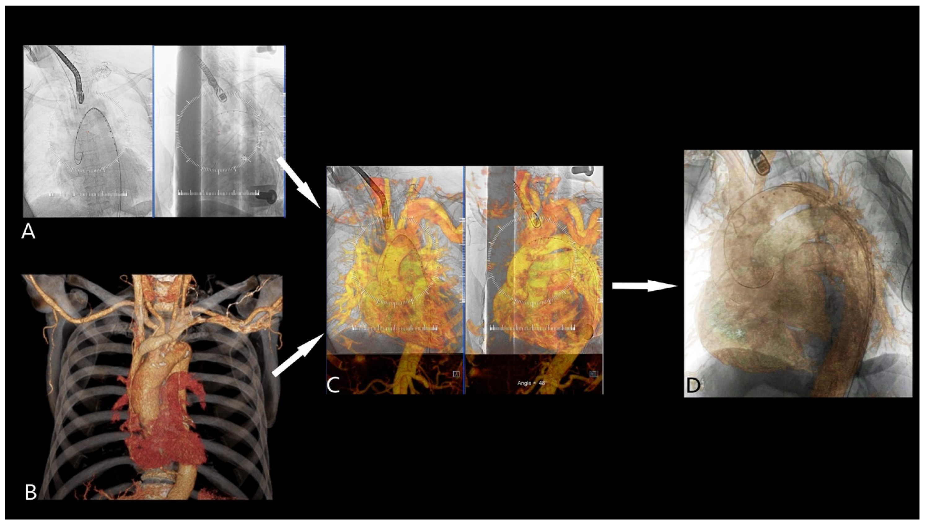Jcm 14 00301 g003 Jcm 14 00301 g003