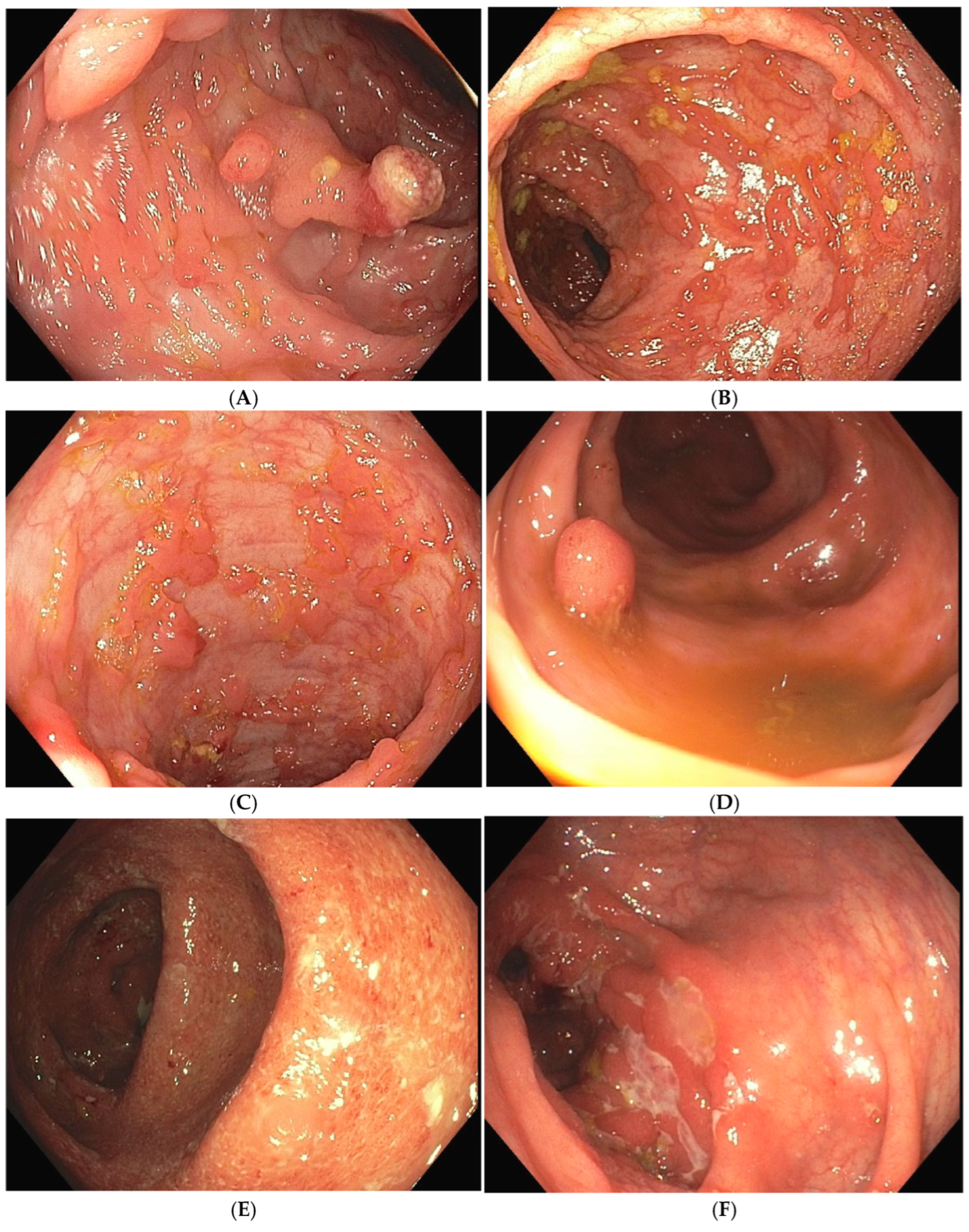 Jcm 14 00333 g001 Jcm 14 00333 g001