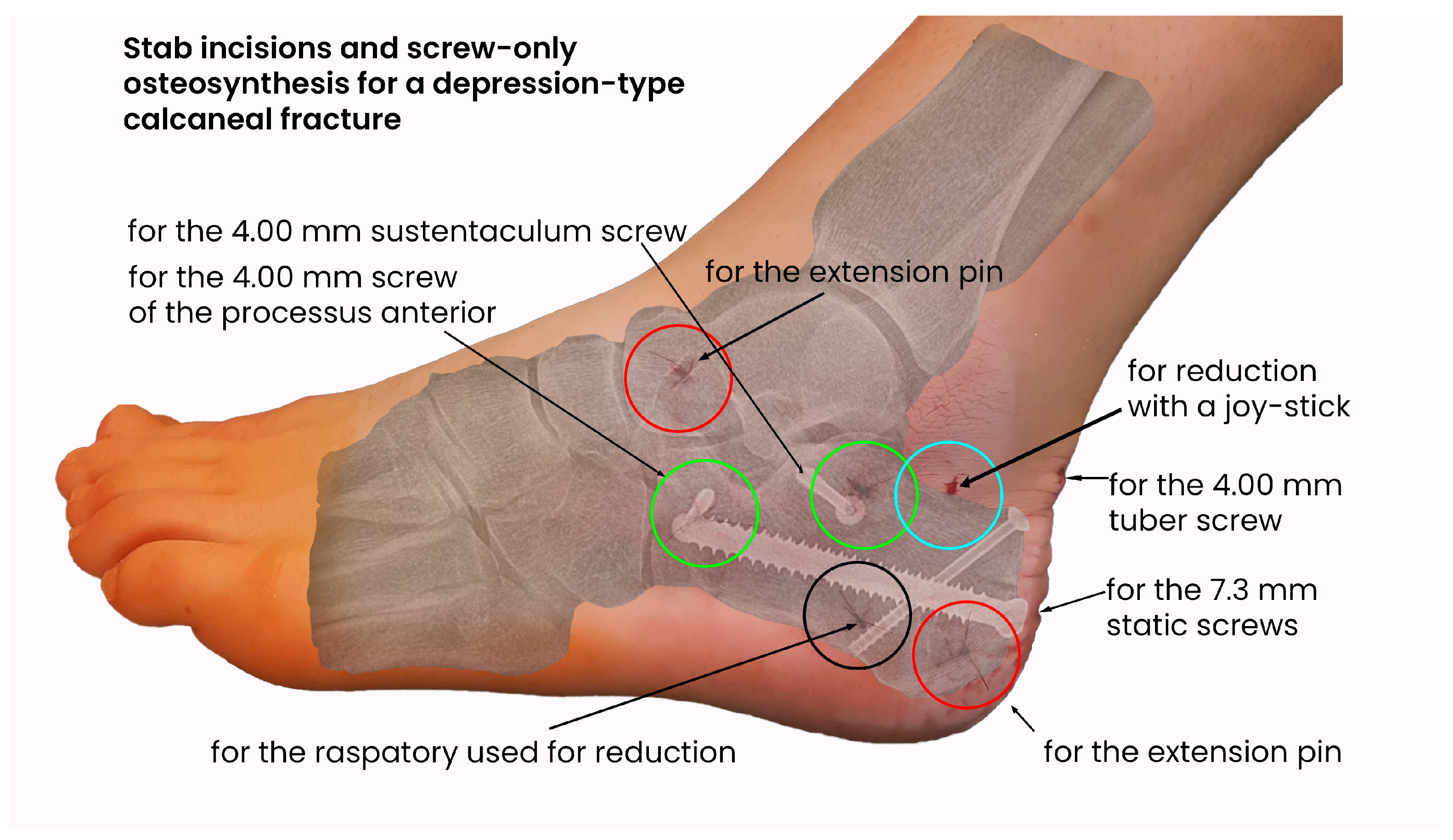 Jcm 14 00344 g002 Jcm 14 00344 g002