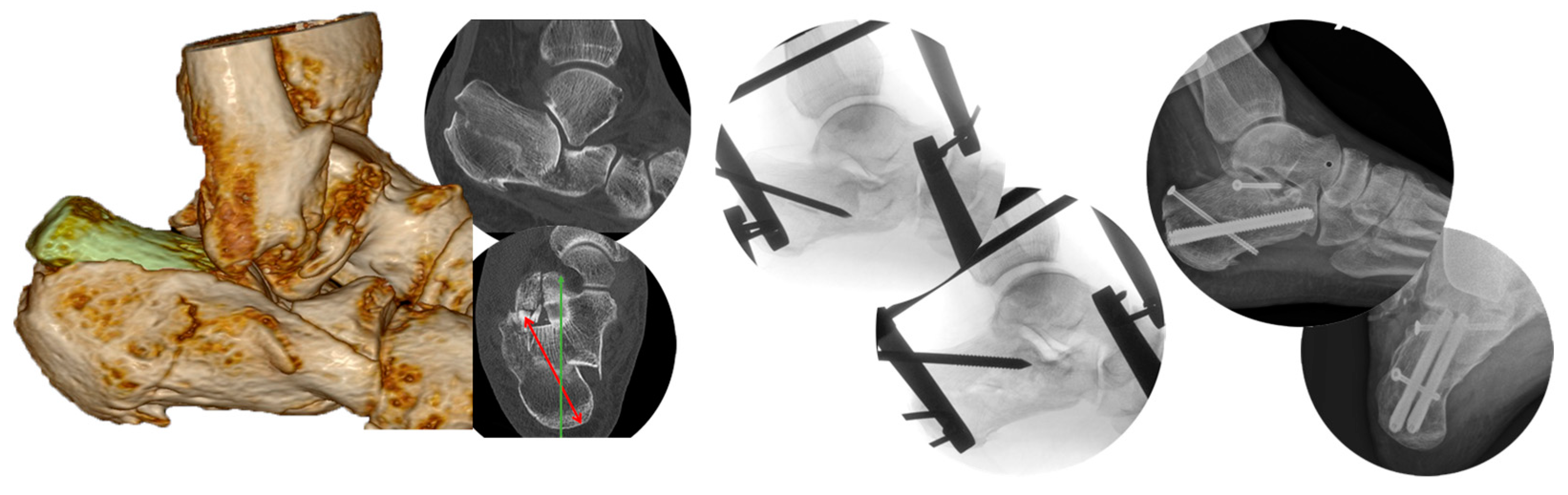 Jcm 14 00344 g003 Jcm 14 00344 g003