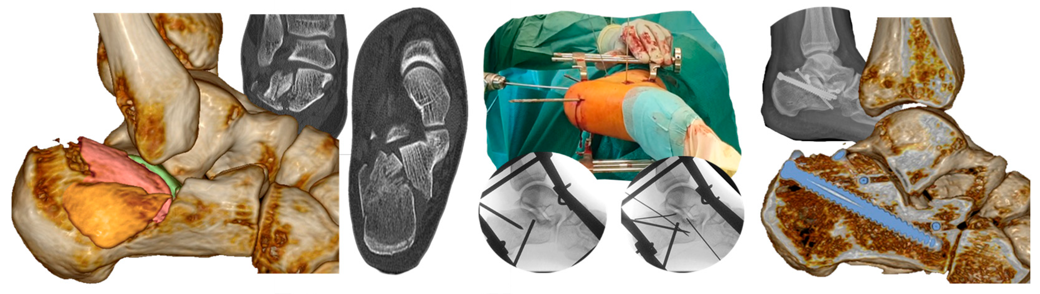 Jcm 14 00344 g004 Jcm 14 00344 g004