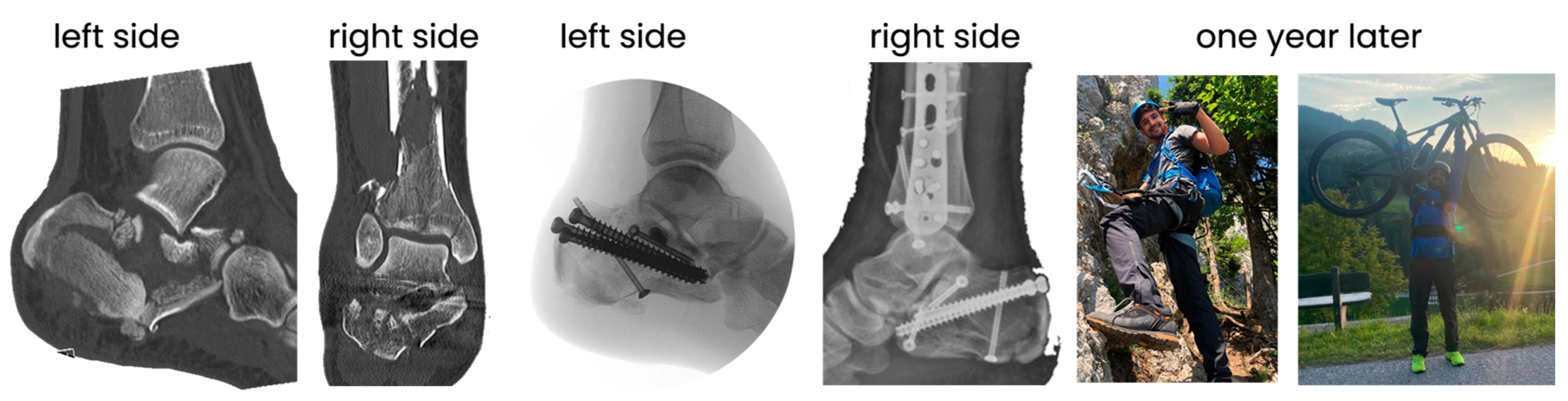 Jcm 14 00344 g005 Jcm 14 00344 g005