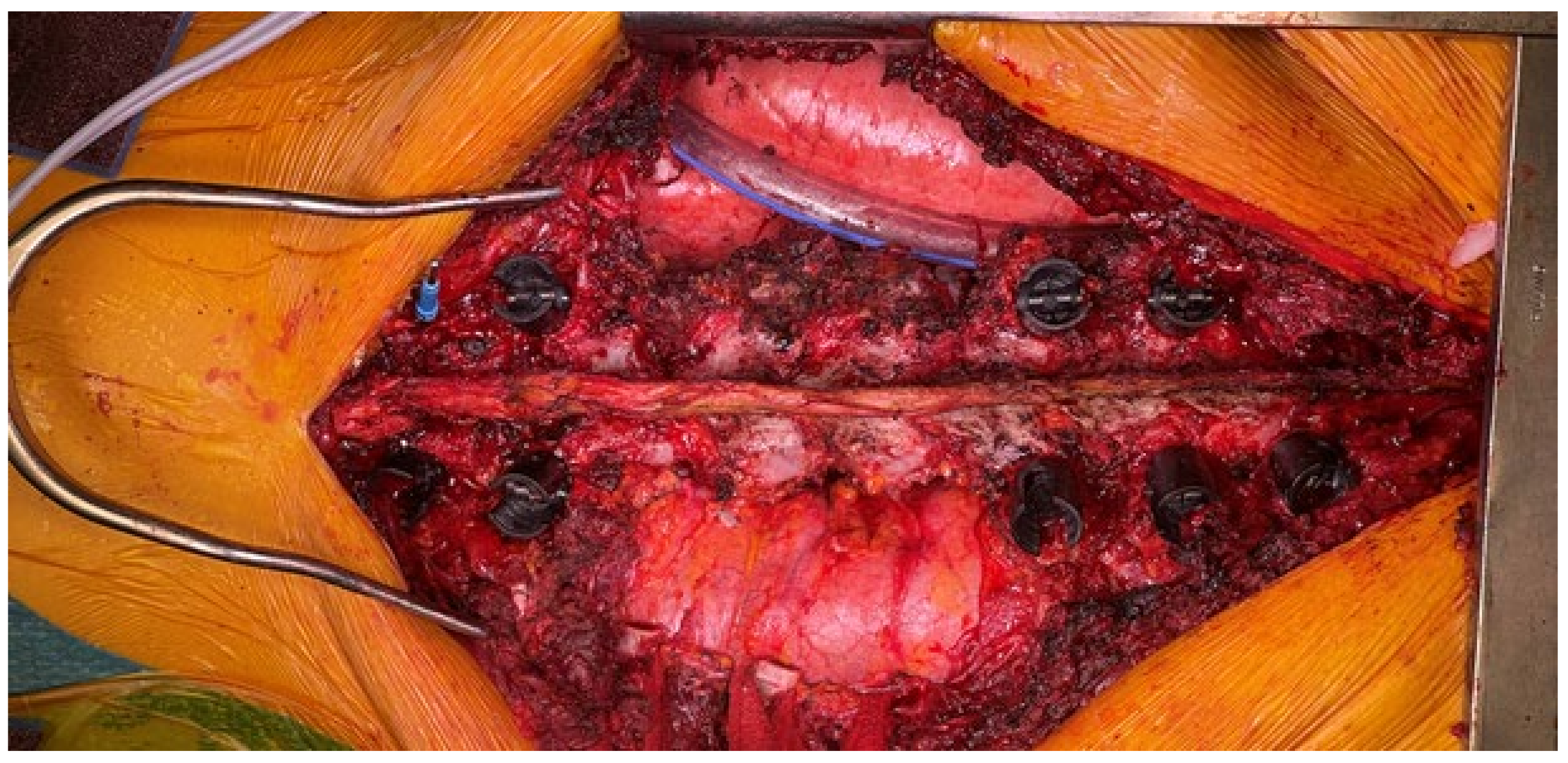 Jcm 14 00349 g005 Jcm 14 00349 g005