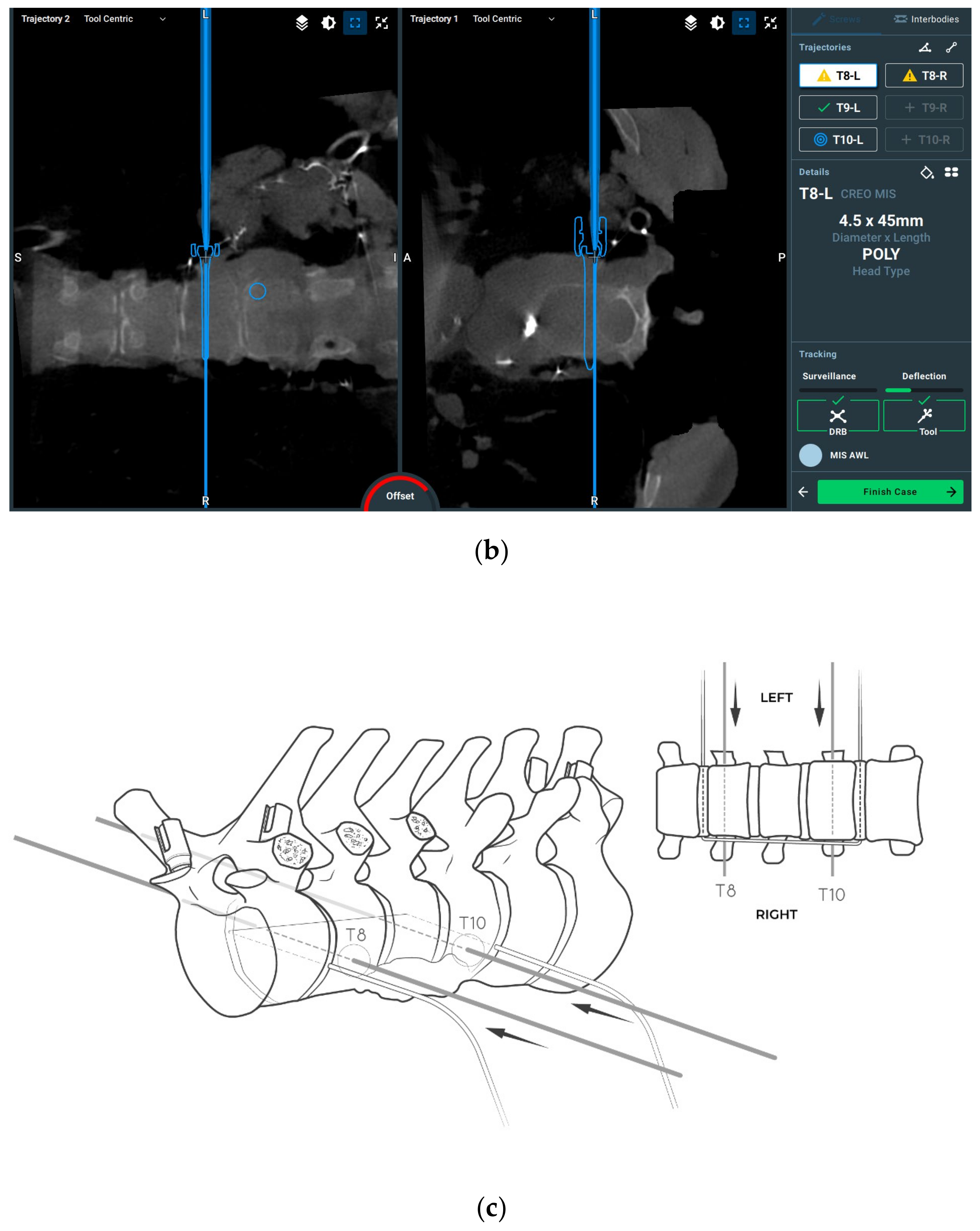 Jcm 14 00349 g006b Jcm 14 00349 g006b