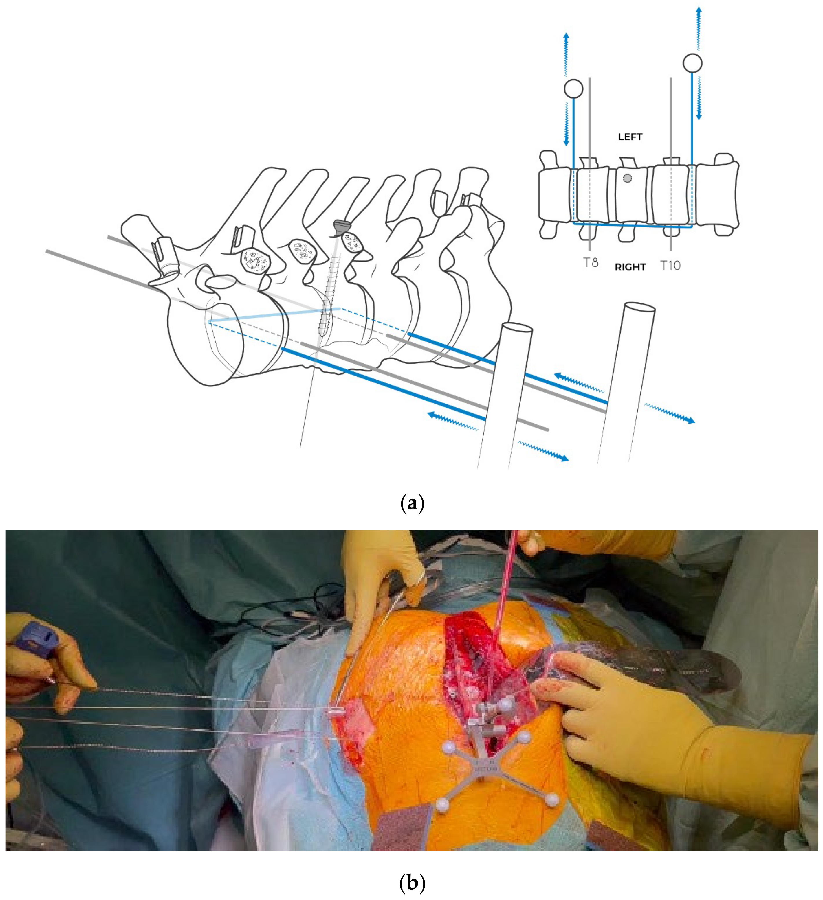 Jcm 14 00349 g008 Jcm 14 00349 g008