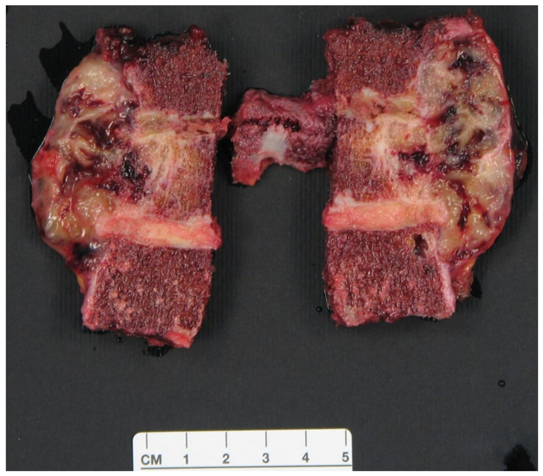 Jcm 14 00349 g012 Jcm 14 00349 g012