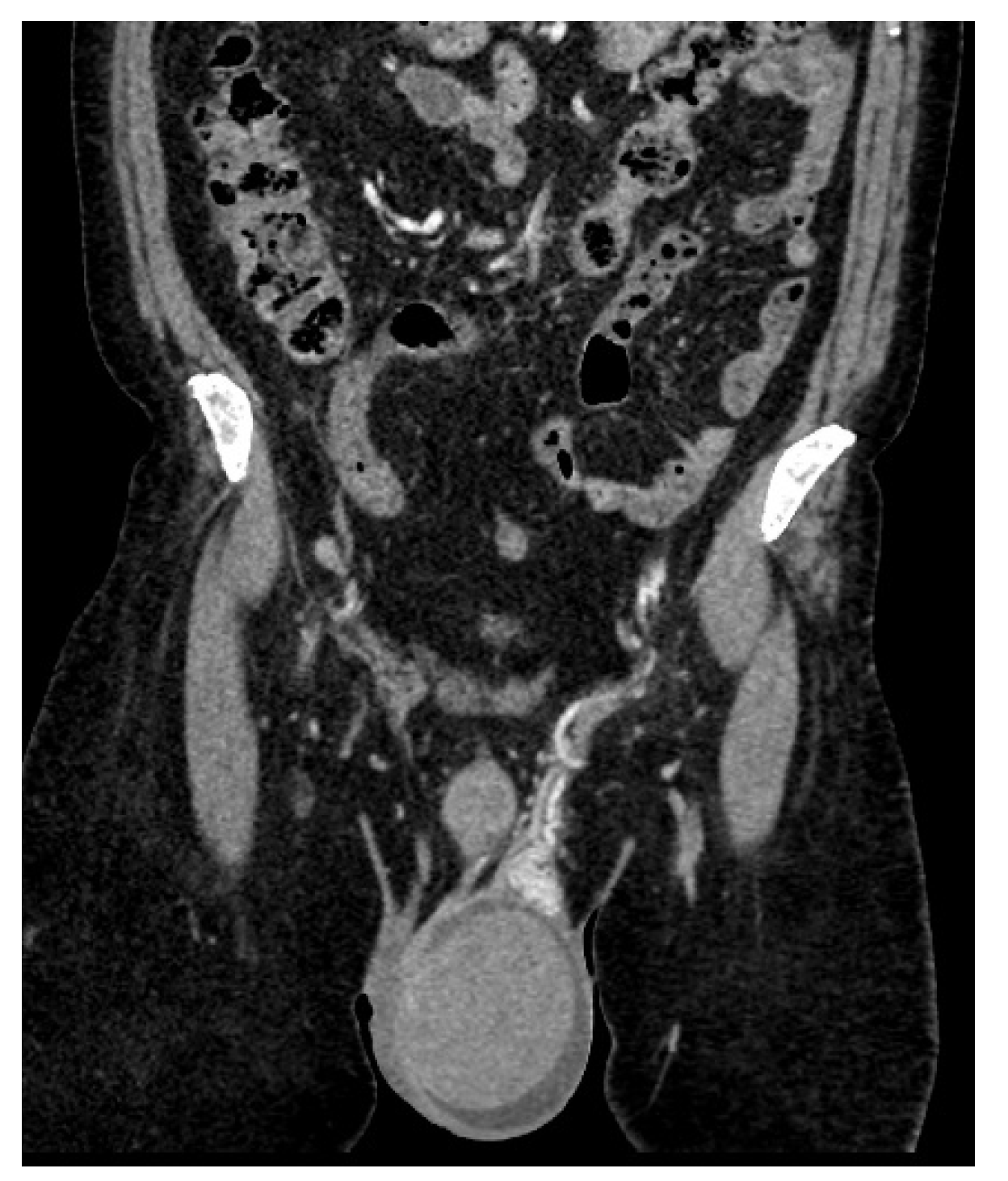 Jcm 14 00405 g004 Jcm 14 00405 g004