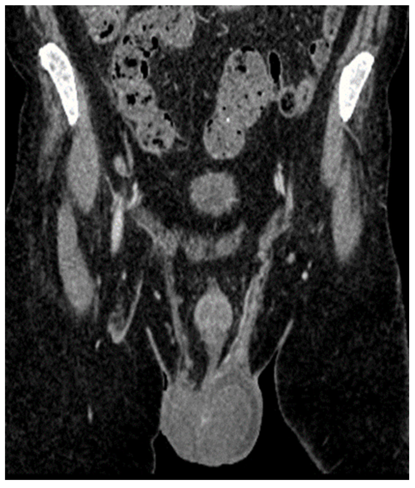 Jcm 14 00405 g008 Jcm 14 00405 g008