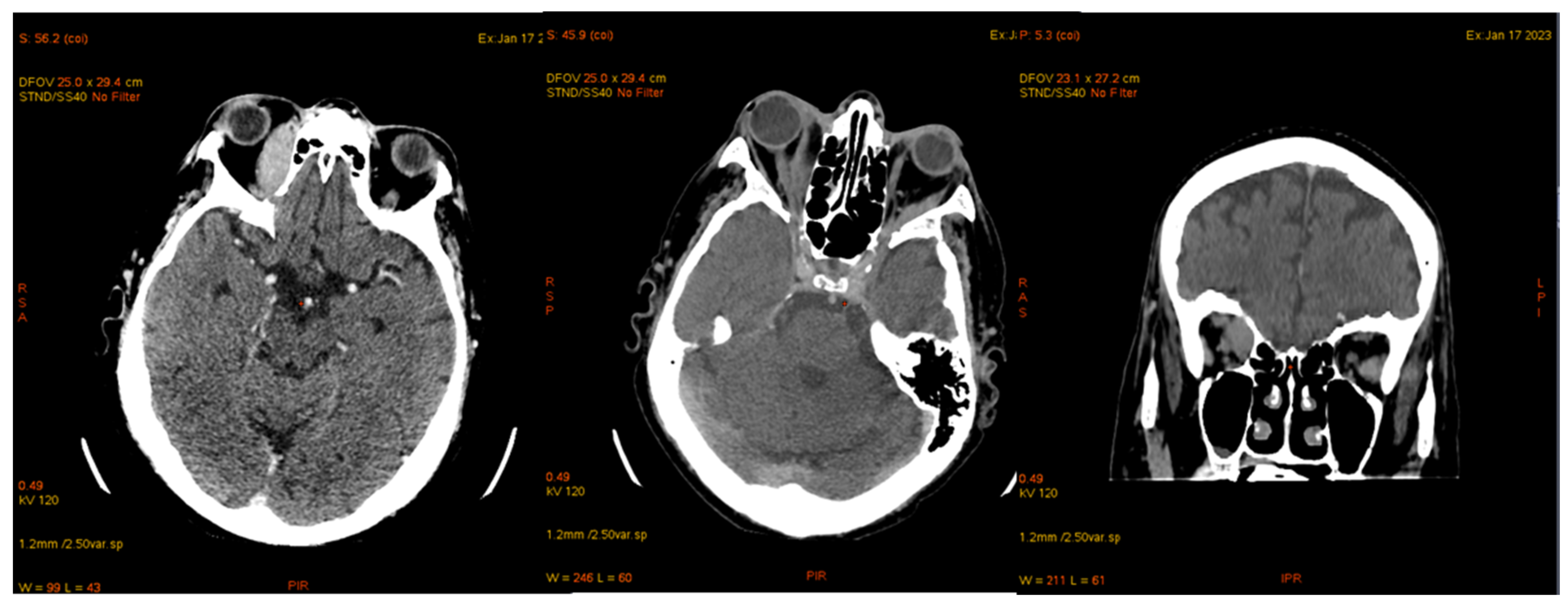 Jcm 14 00405 g009 Jcm 14 00405 g009