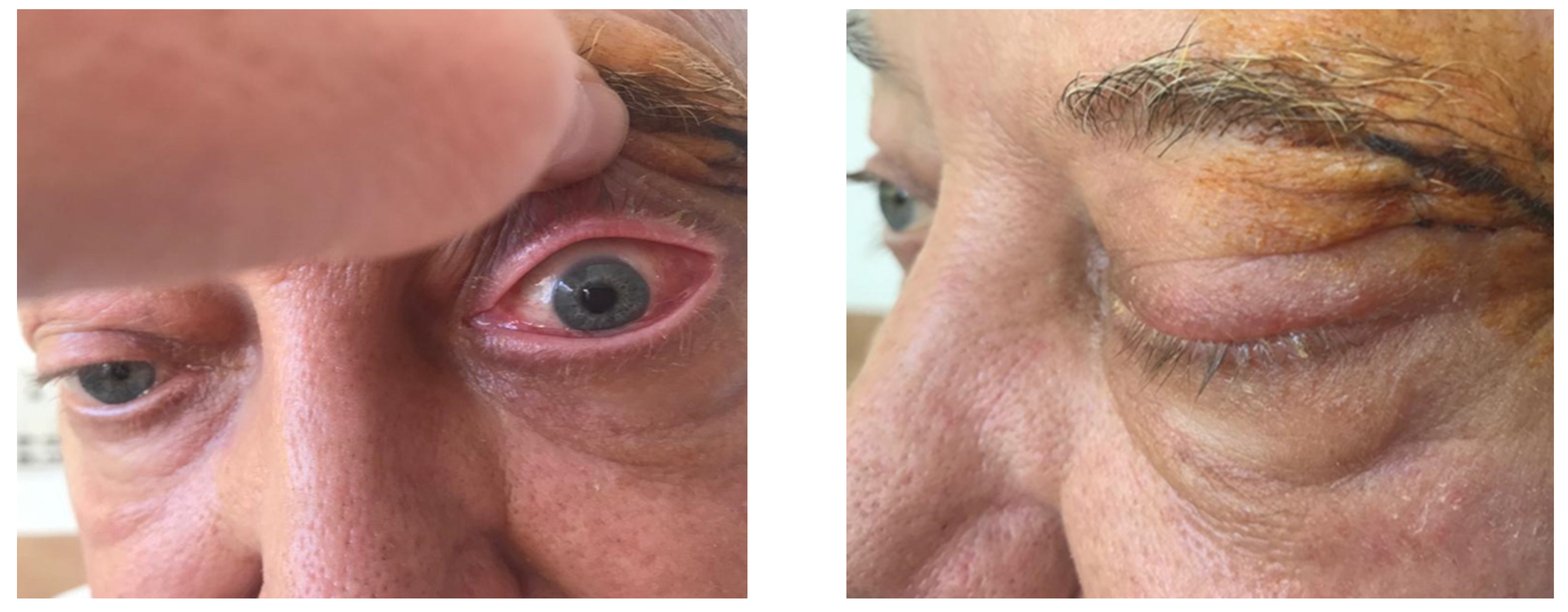 Jcm 14 00405 g011 Jcm 14 00405 g011