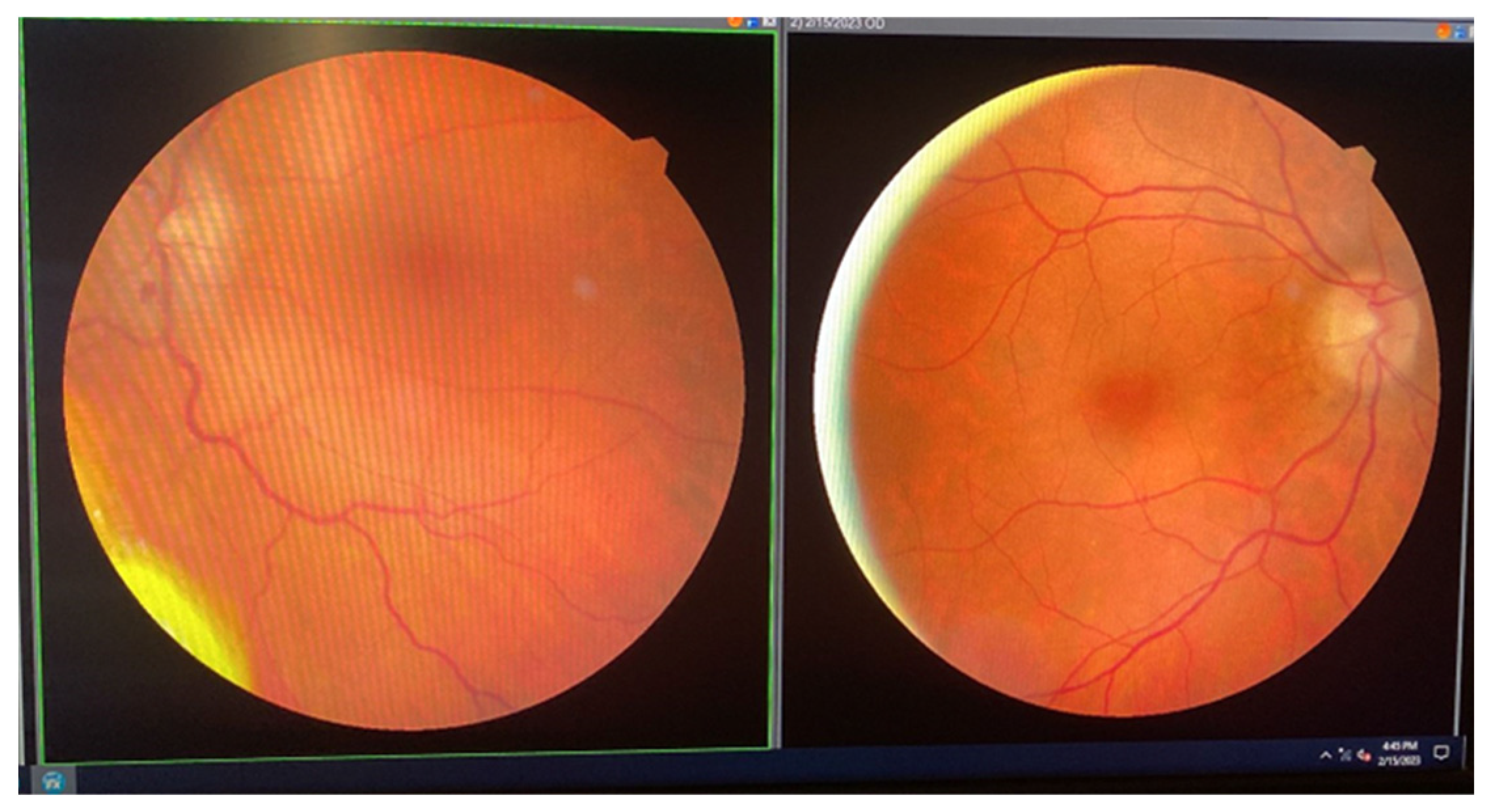 Jcm 14 00405 g012 Jcm 14 00405 g012