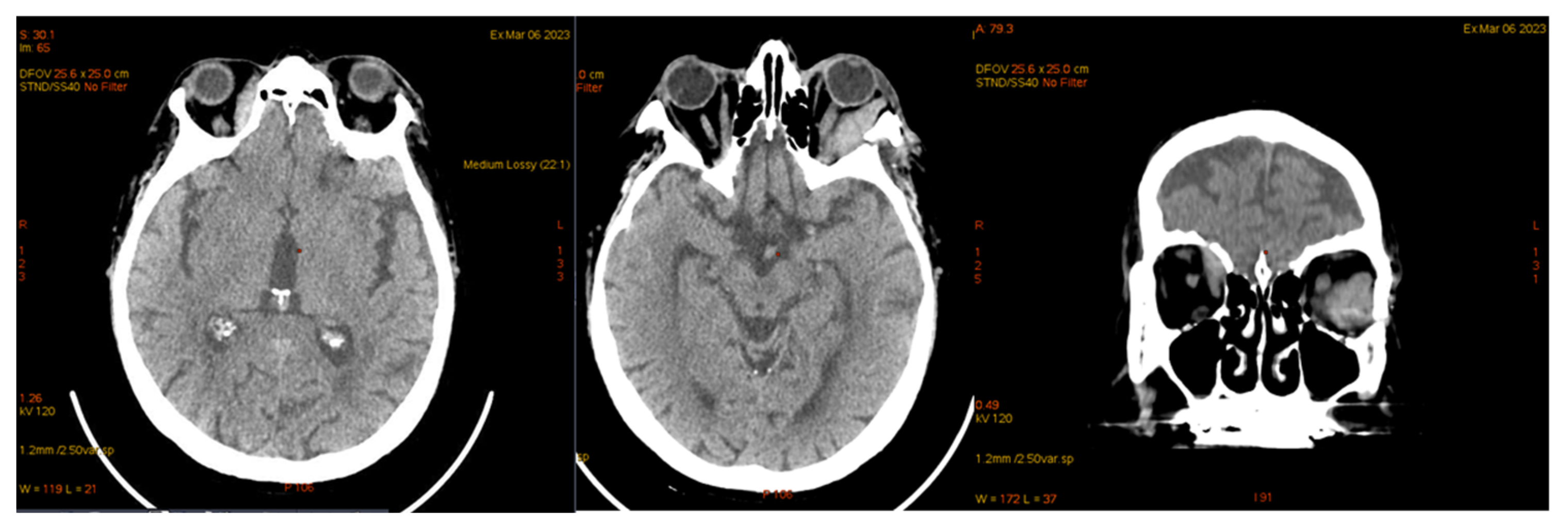 Jcm 14 00405 g013 Jcm 14 00405 g013