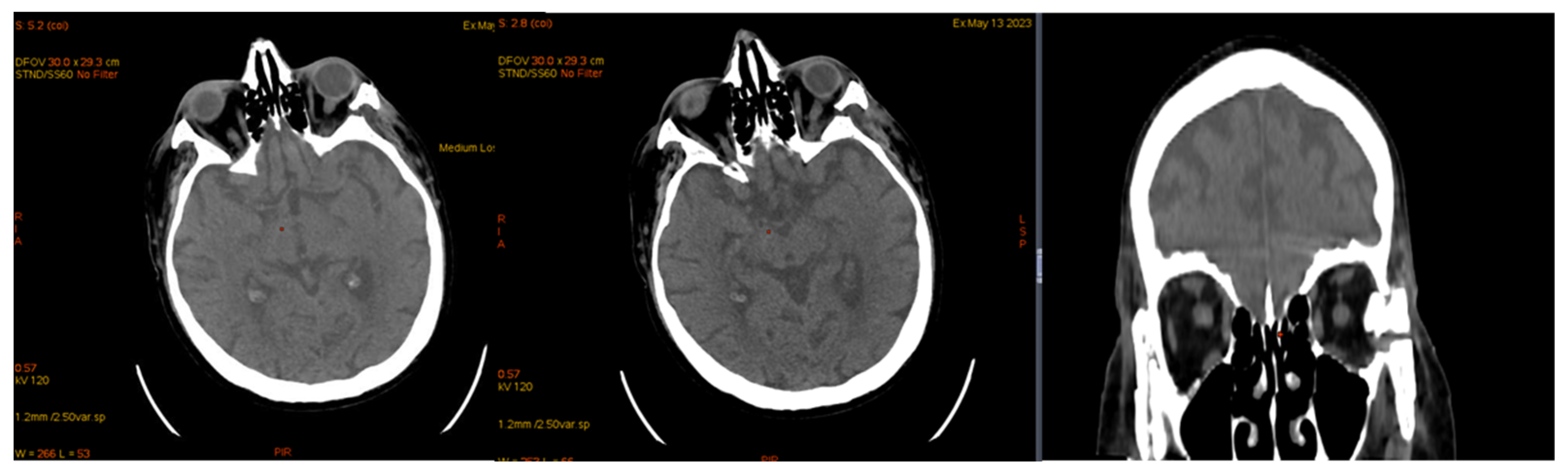Jcm 14 00405 g014 Jcm 14 00405 g014