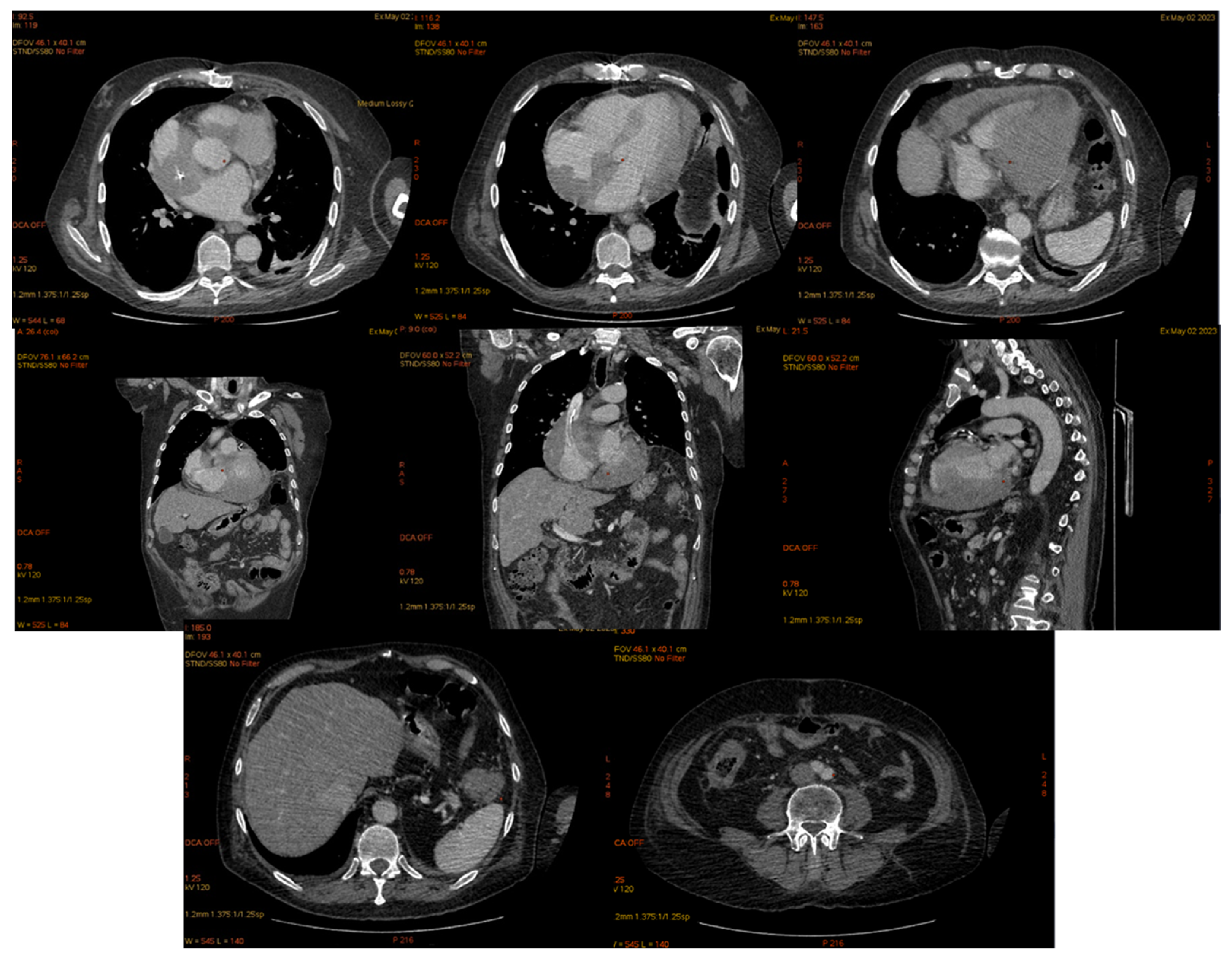 Jcm 14 00405 g017 Jcm 14 00405 g017