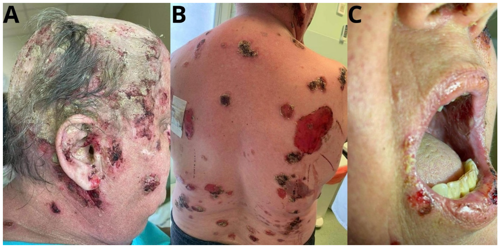 Jcm 14 00409 g001 Jcm 14 00409 g001