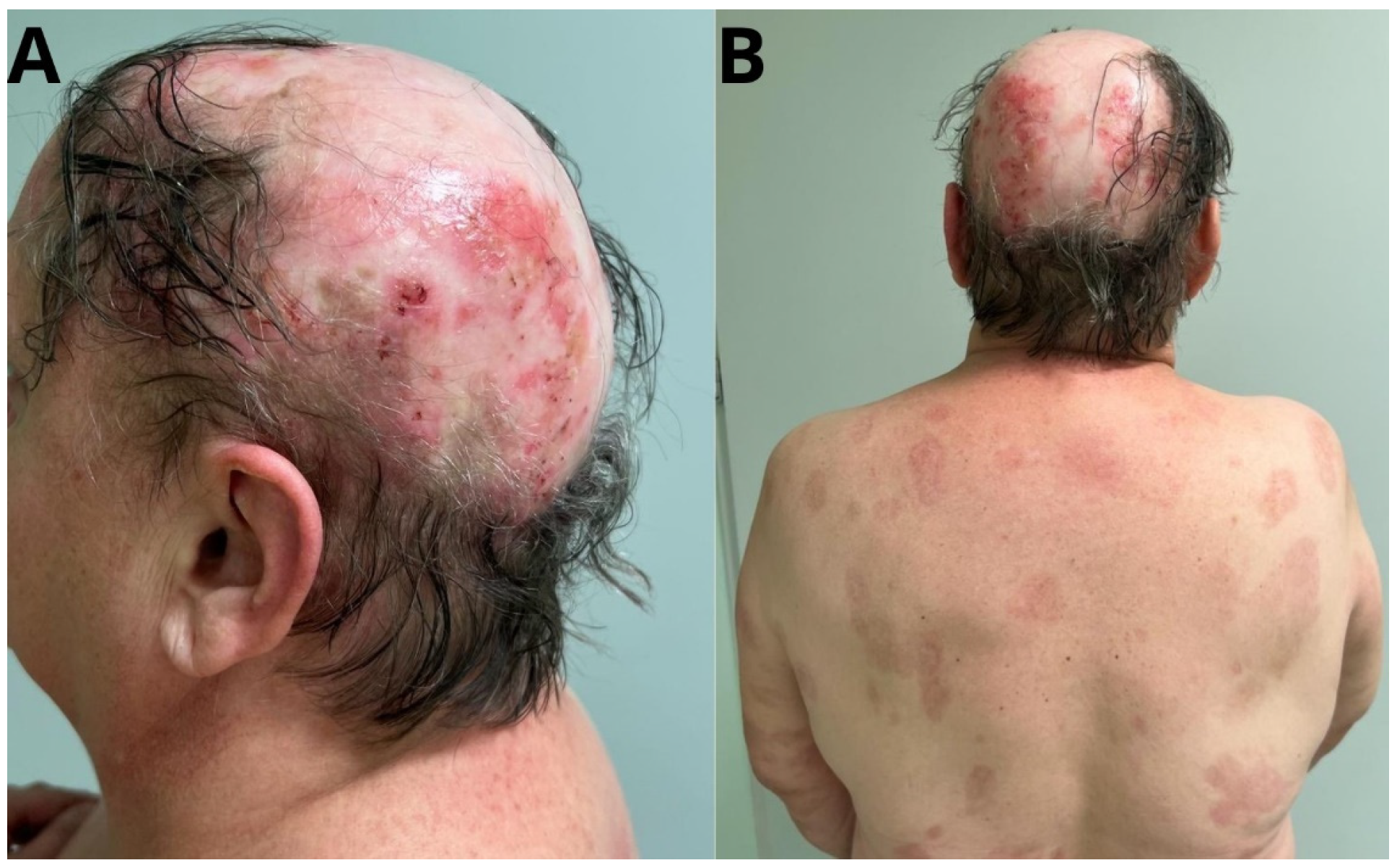 Jcm 14 00409 g003 Jcm 14 00409 g003