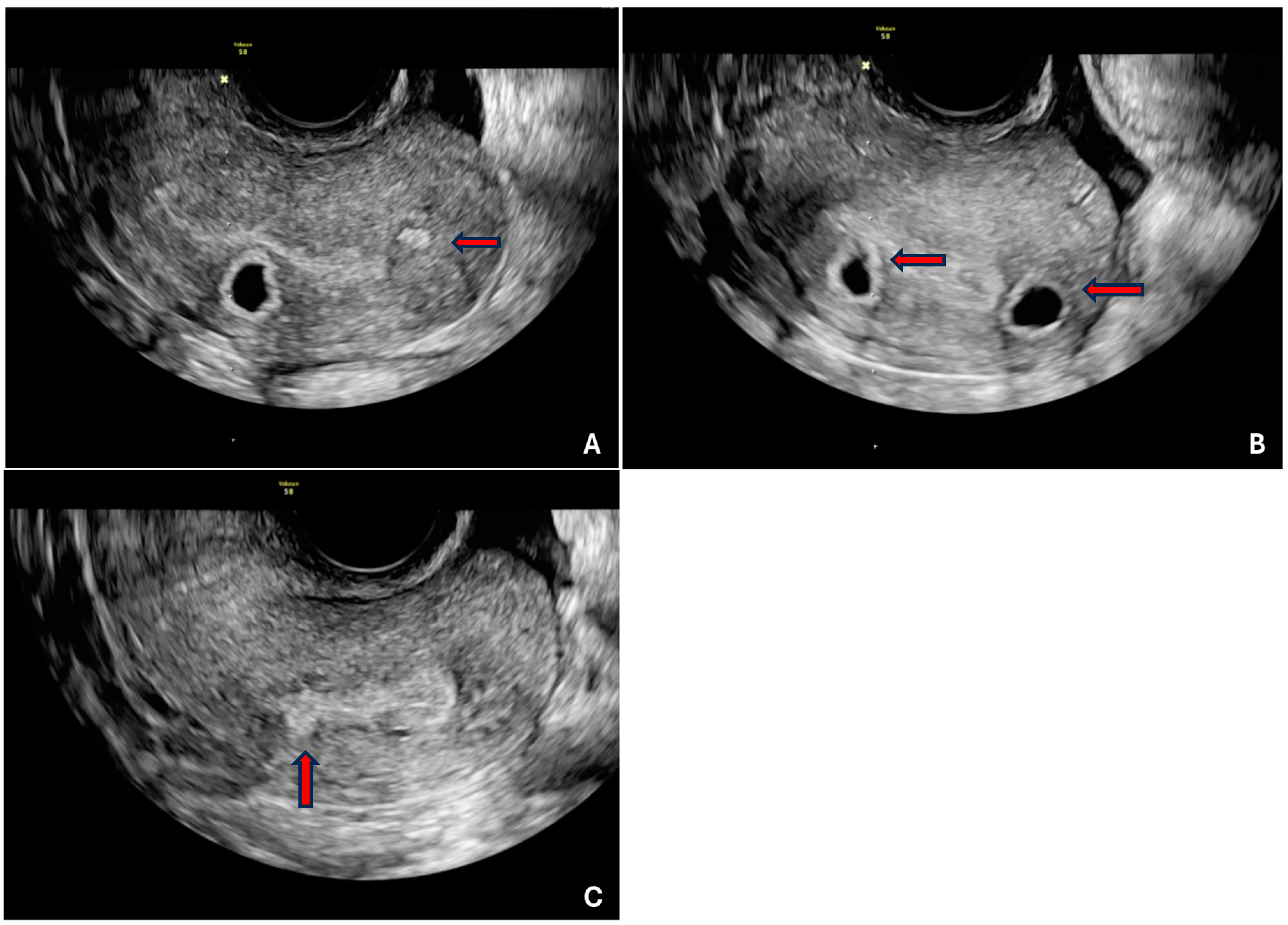 What is myometrial echo pattern in dogs infoupdate