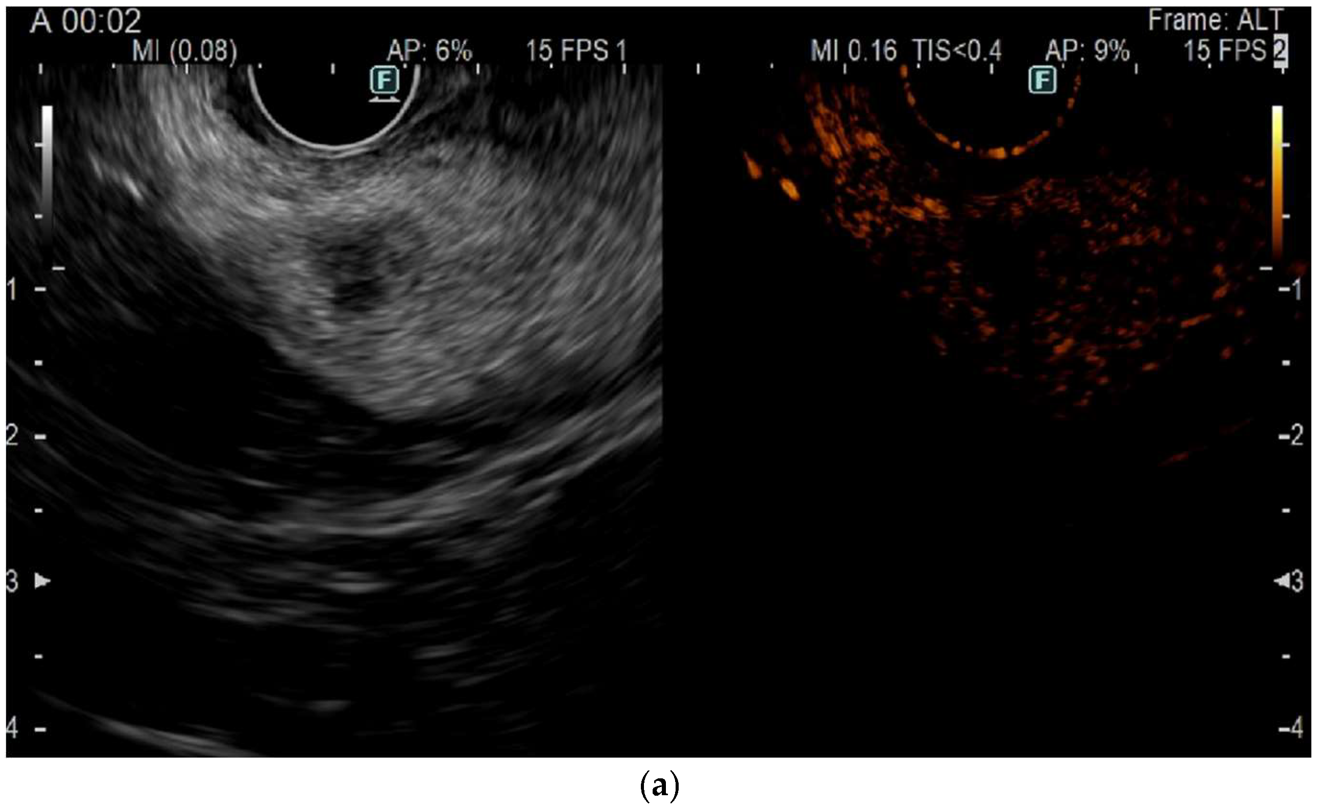 Jcm 14 00495 g001a Jcm 14 00495 g001a