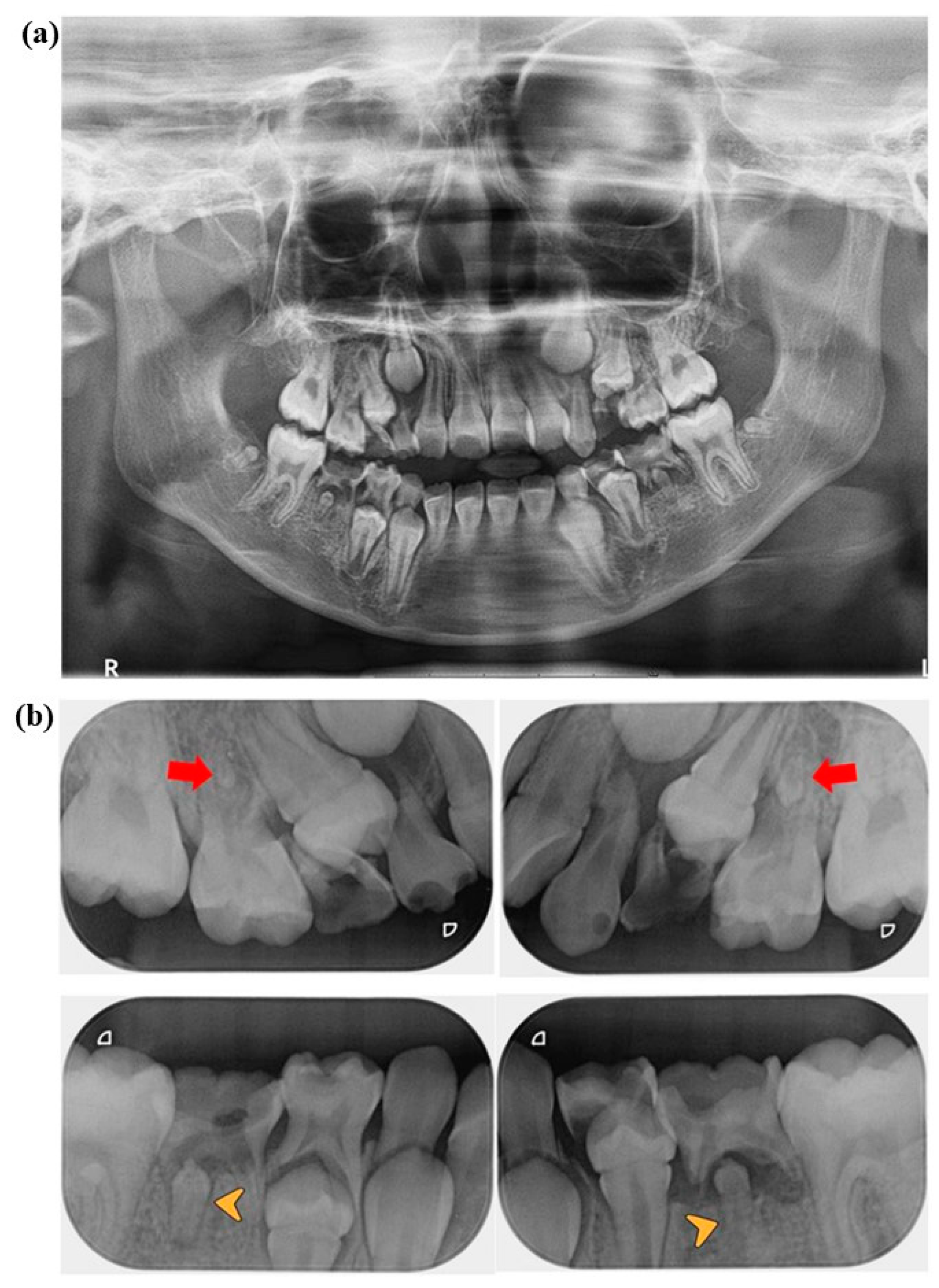Jcm 14 00603 g001 Jcm 14 00603 g001