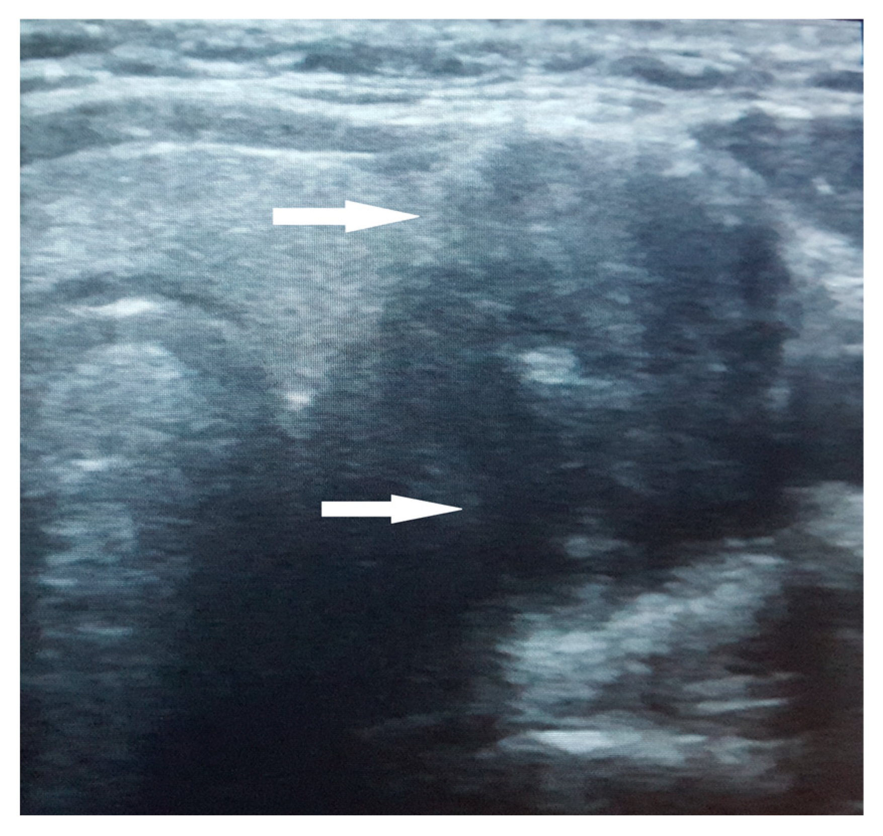 Jcm 14 00610 g001 Jcm 14 00610 g001