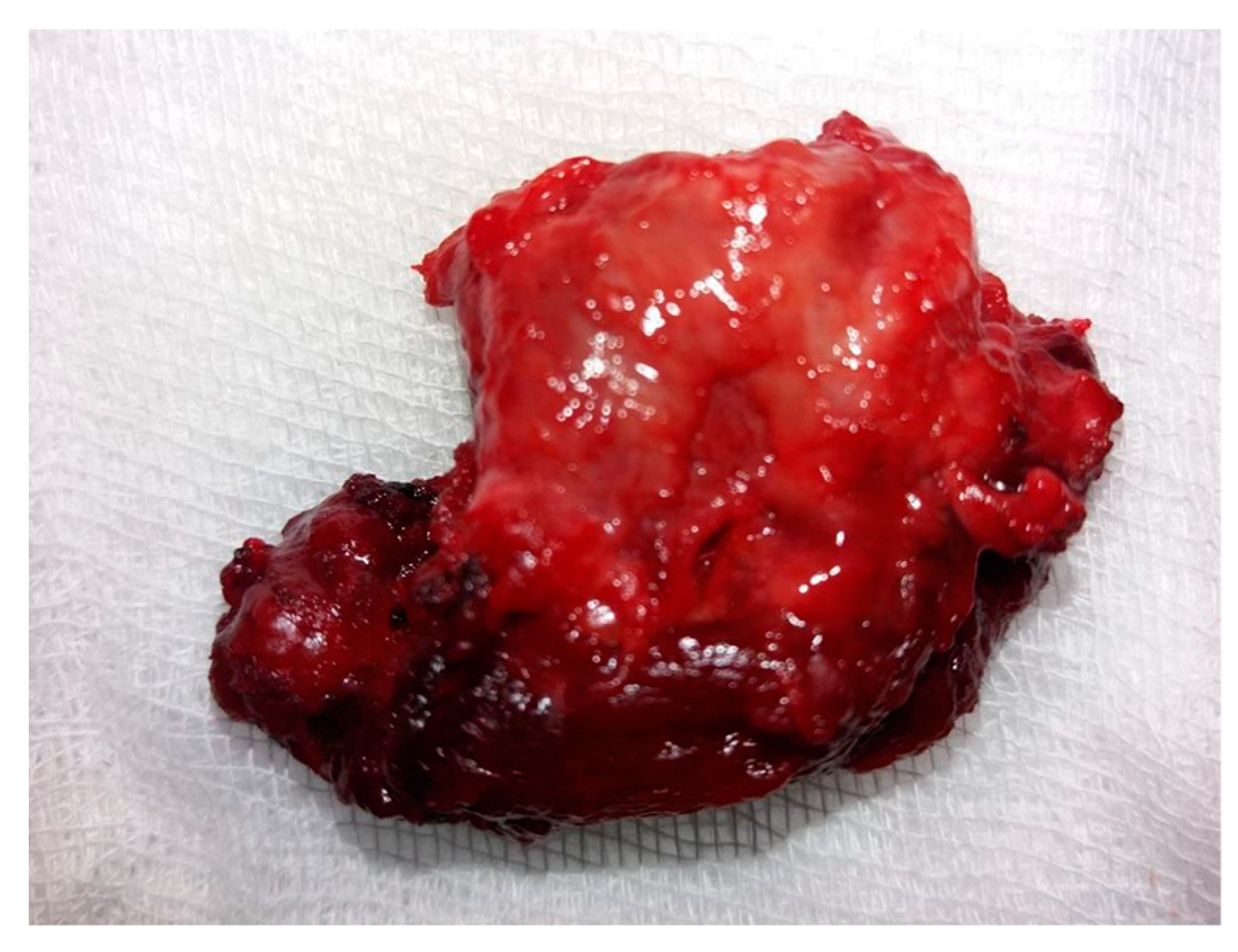 Jcm 14 00610 g003 Jcm 14 00610 g003