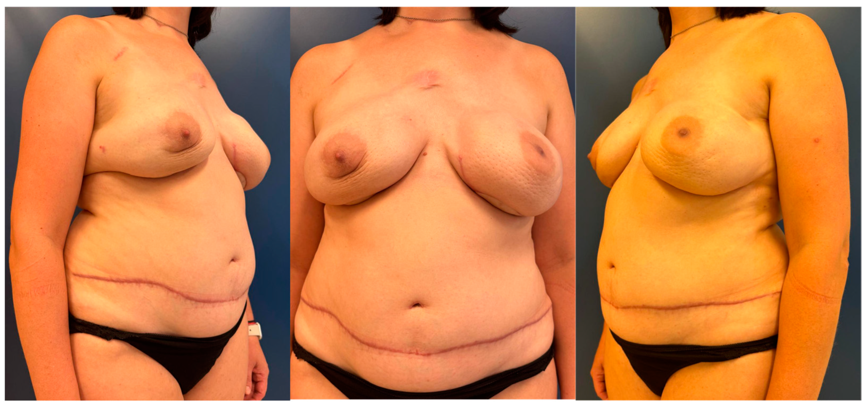 Jcm 14 01056 g002 Jcm 14 01056 g002