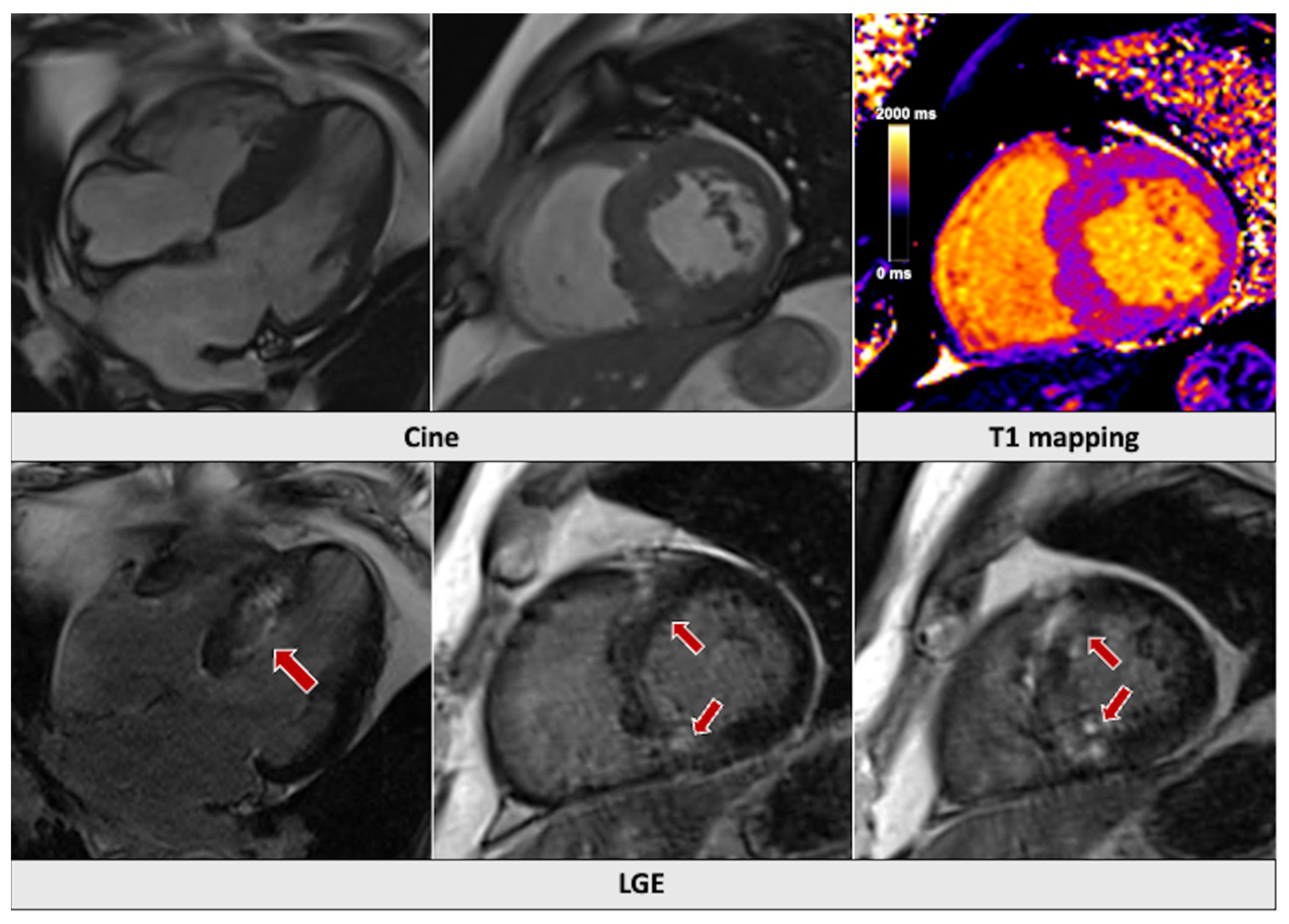 Jcm 14 01112 g003 Jcm 14 01112 g003