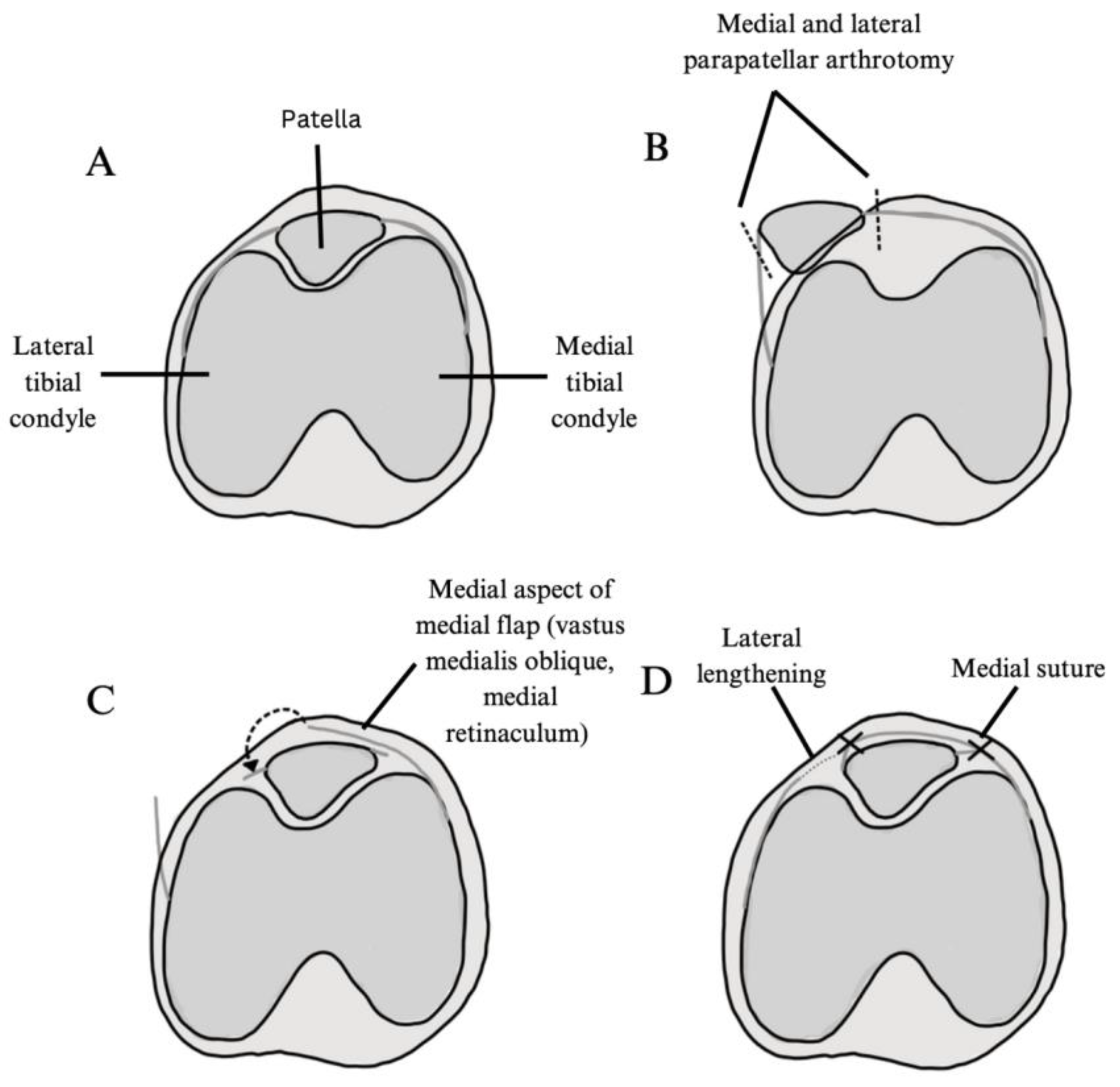 Jcm 14 01116 g003 Jcm 14 01116 g003