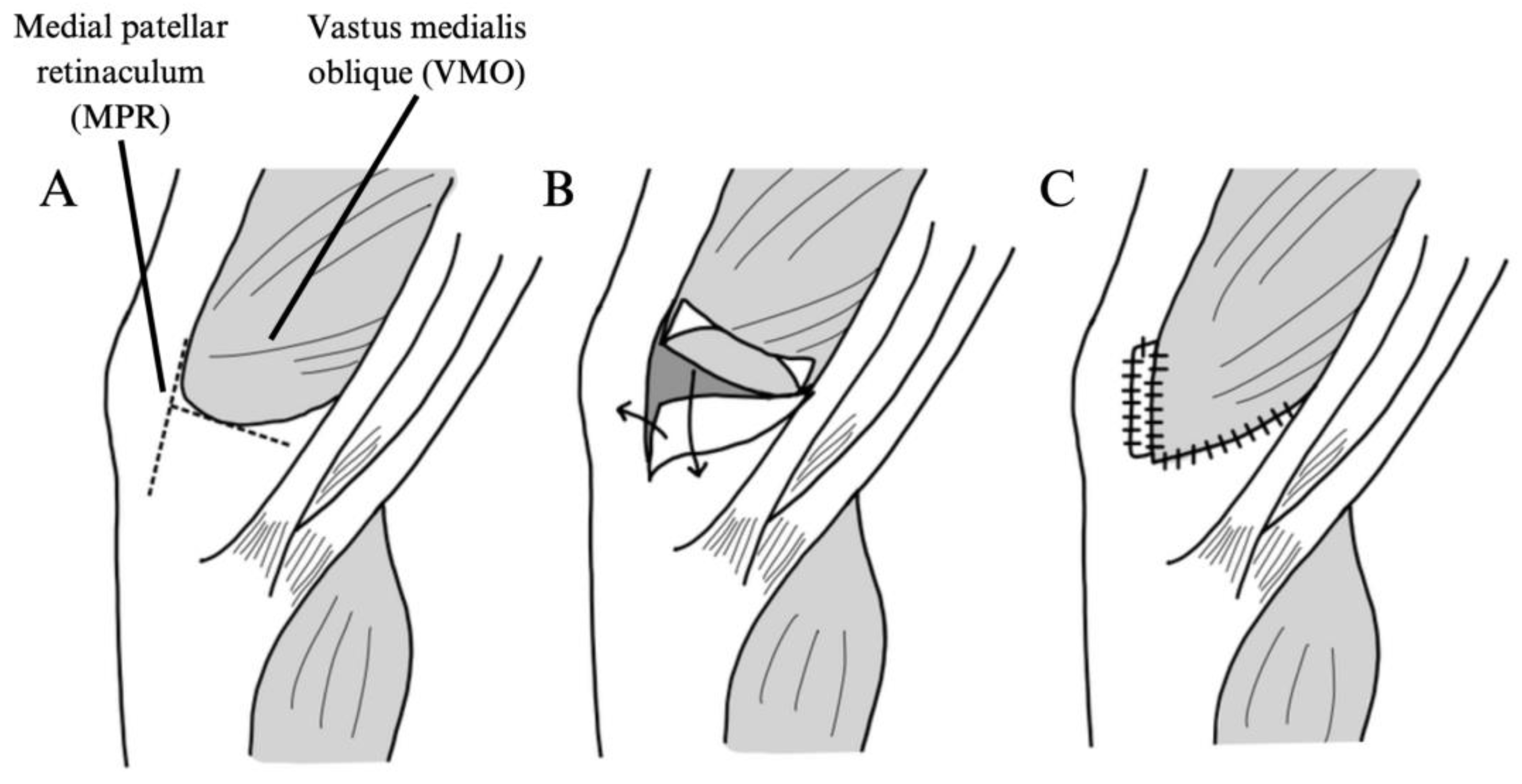 Jcm 14 01116 g004 Jcm 14 01116 g004