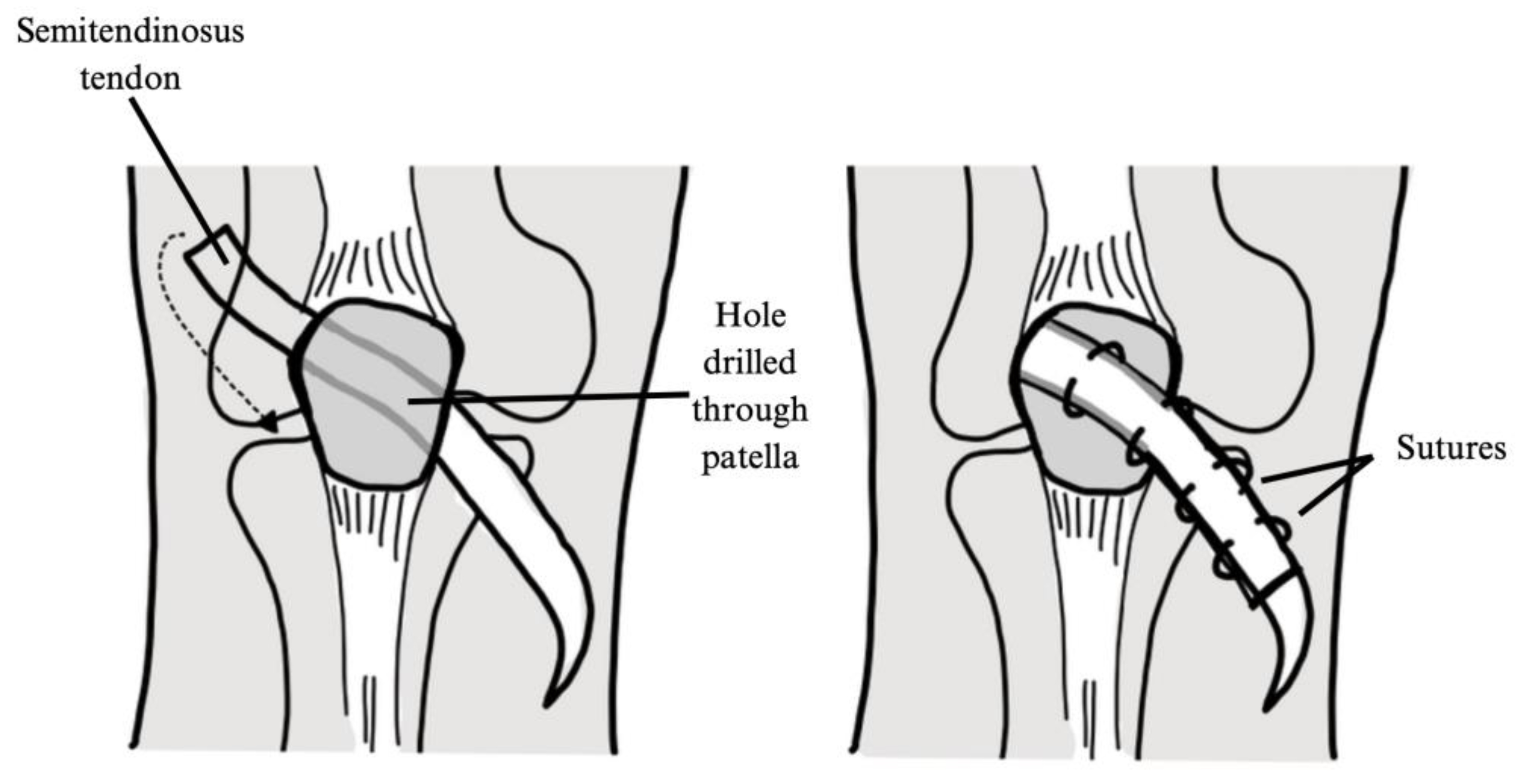 Jcm 14 01116 g006 Jcm 14 01116 g006