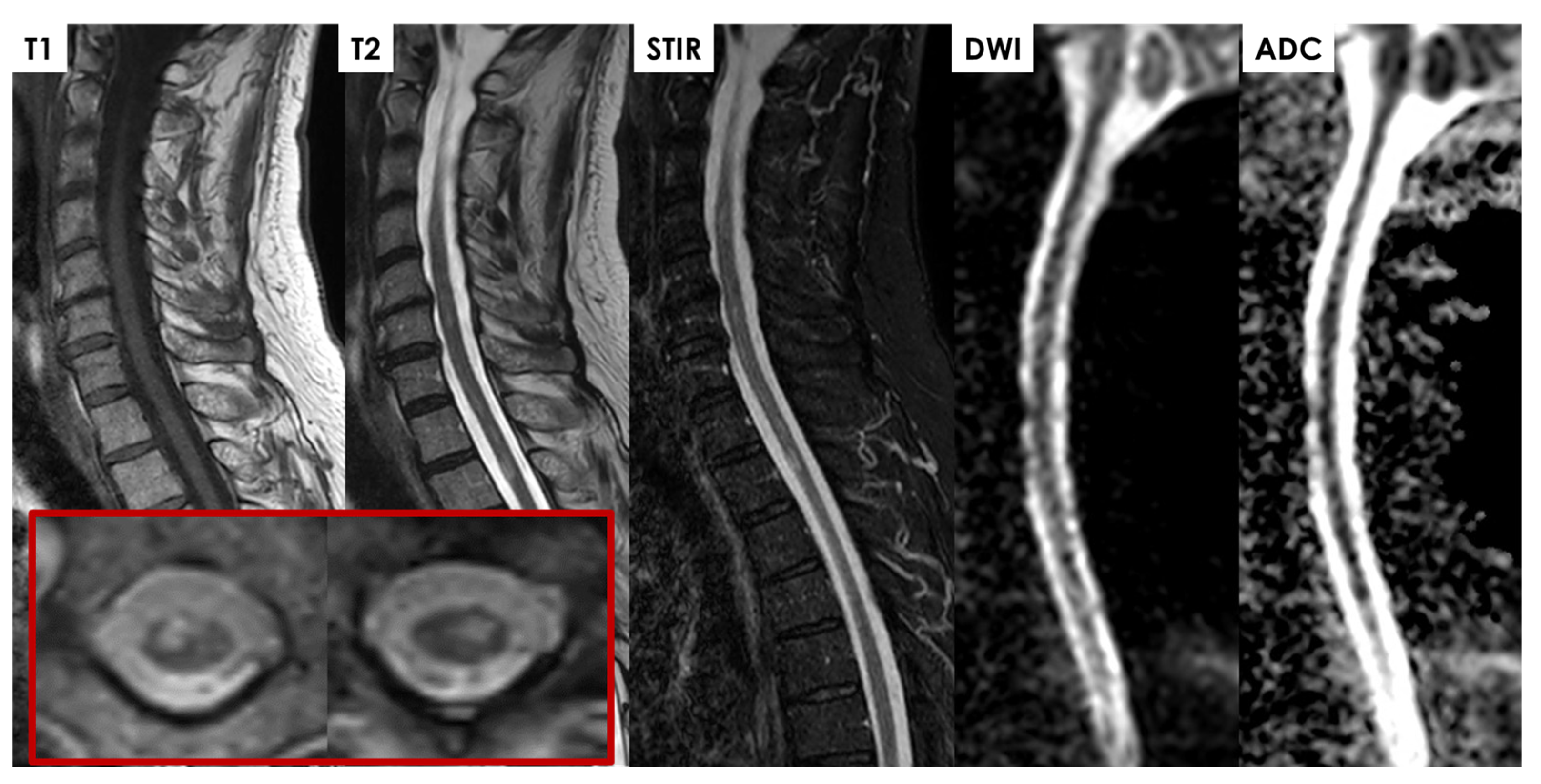 Jcm 14 01293 g005 Jcm 14 01293 g005