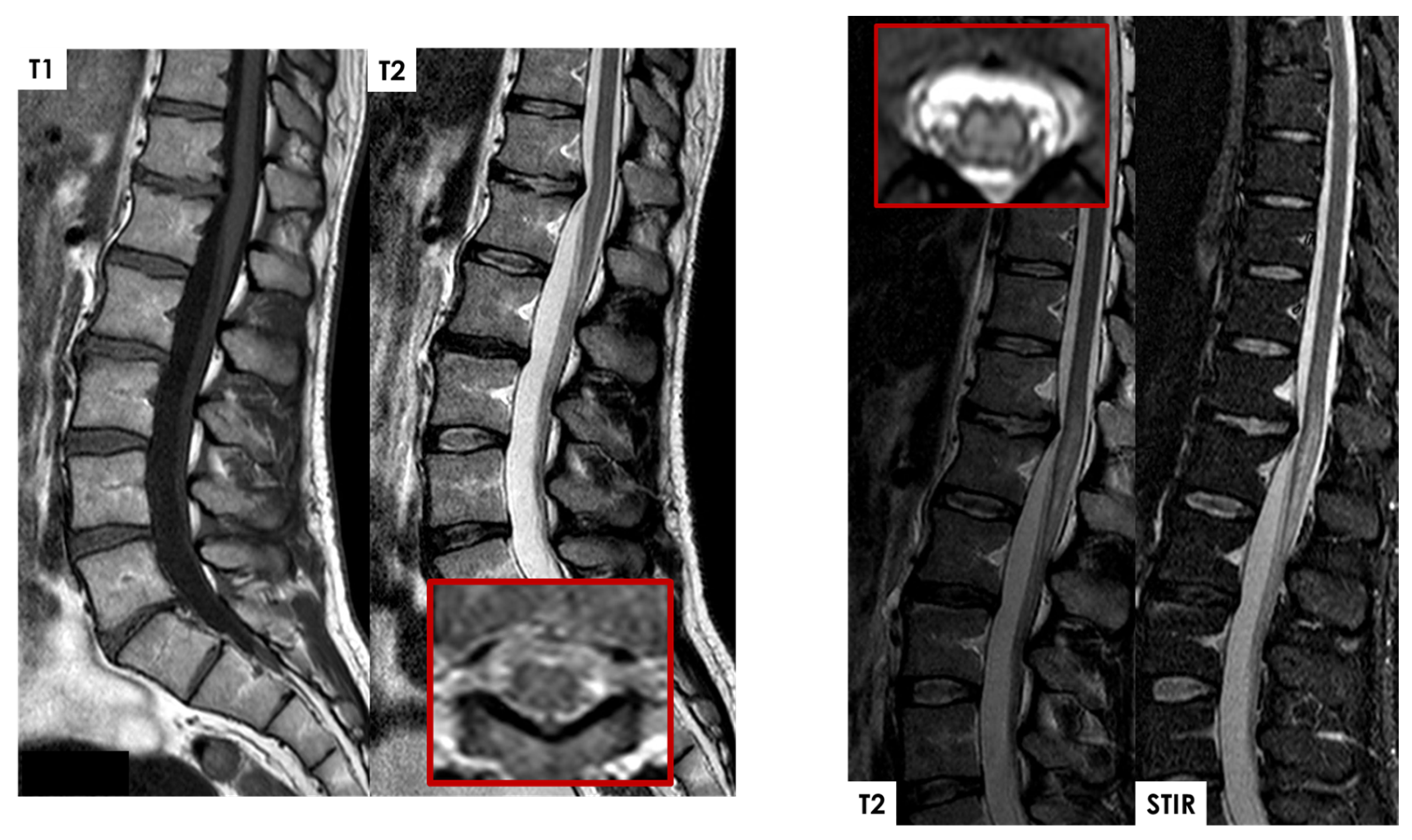 Jcm 14 01293 g006 Jcm 14 01293 g006