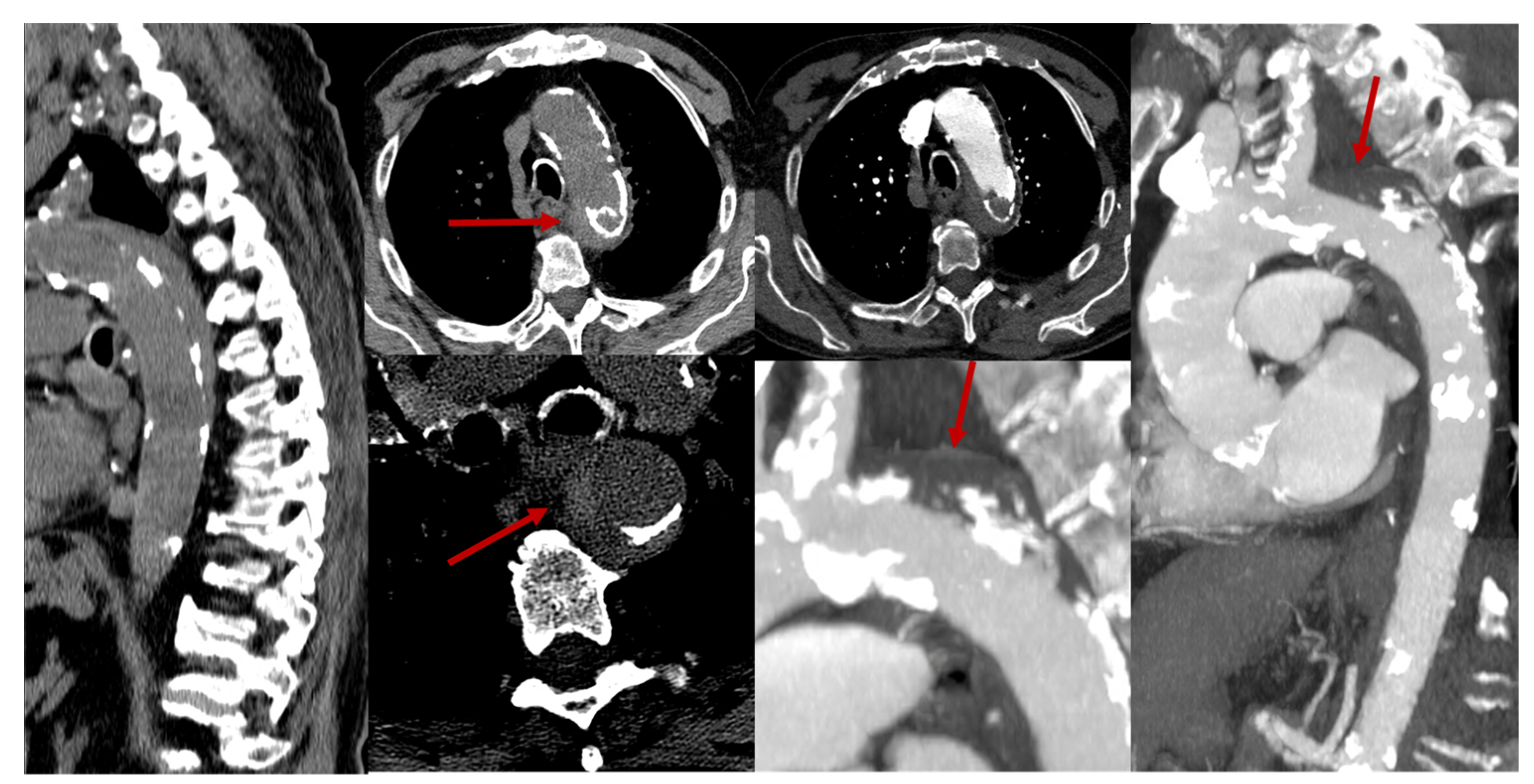 Jcm 14 01293 g007 Jcm 14 01293 g007