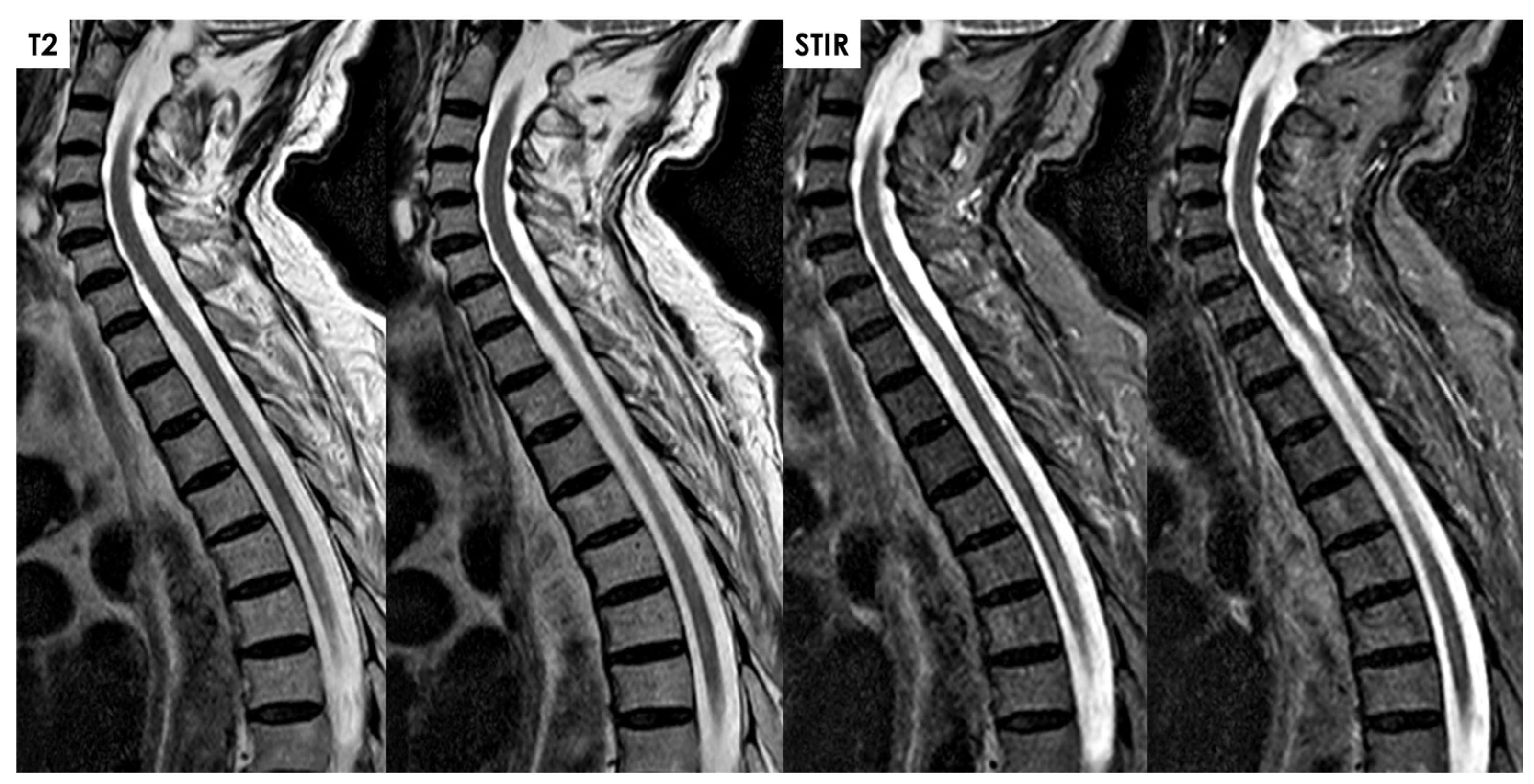 Jcm 14 01293 g008 Jcm 14 01293 g008