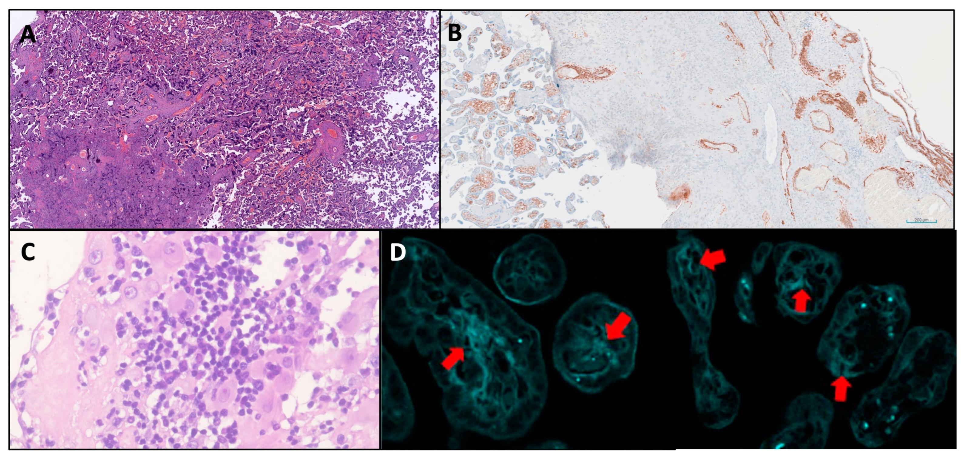 Jcm 14 01299 g001 Jcm 14 01299 g001
