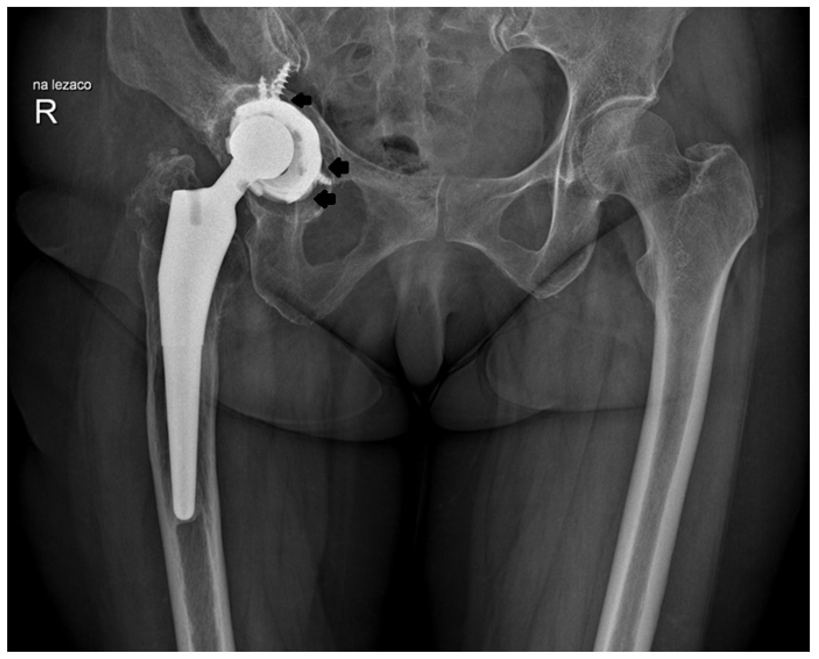 Jcm 14 01301 g004 Jcm 14 01301 g004