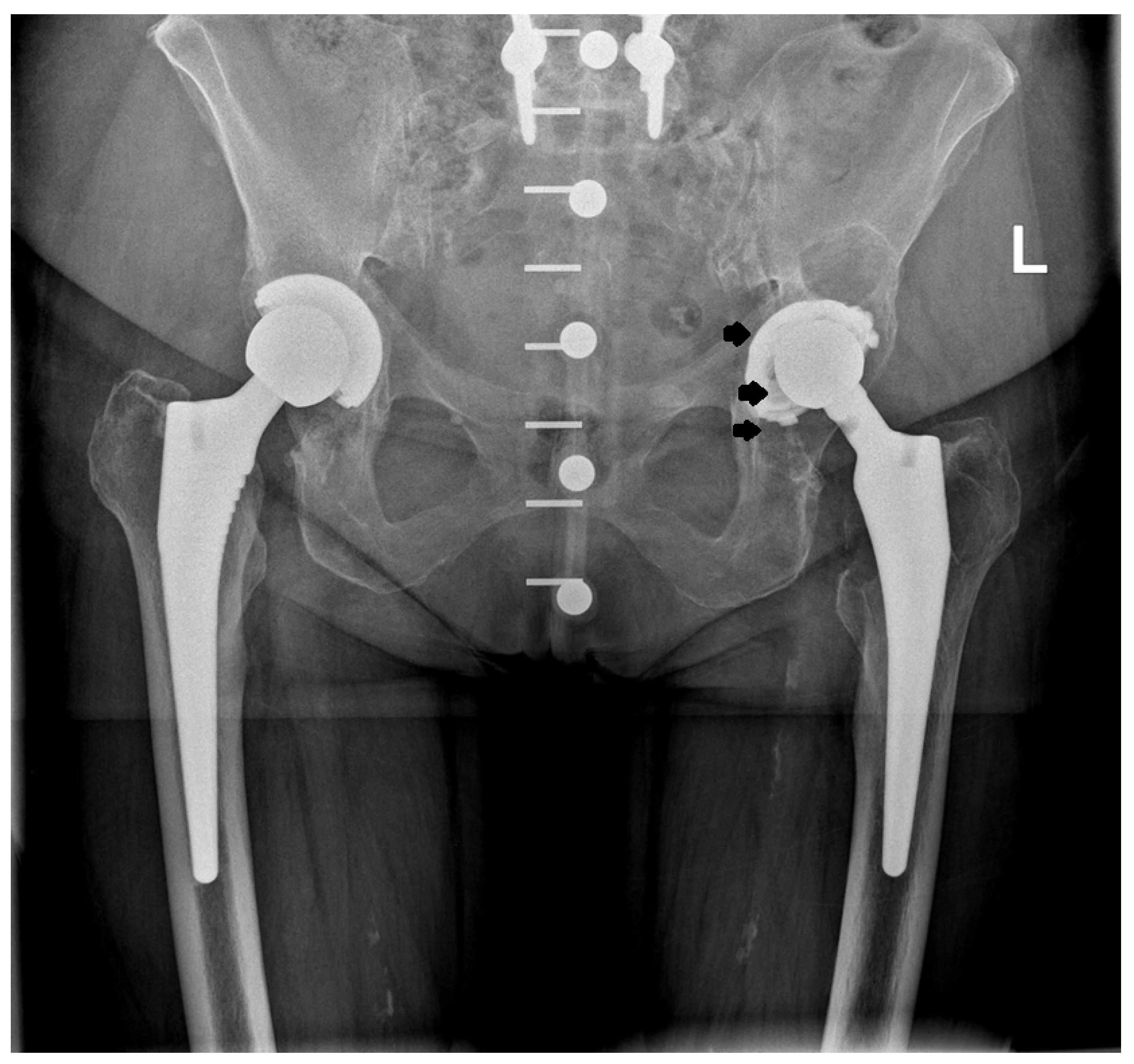 Jcm 14 01301 g006 Jcm 14 01301 g006