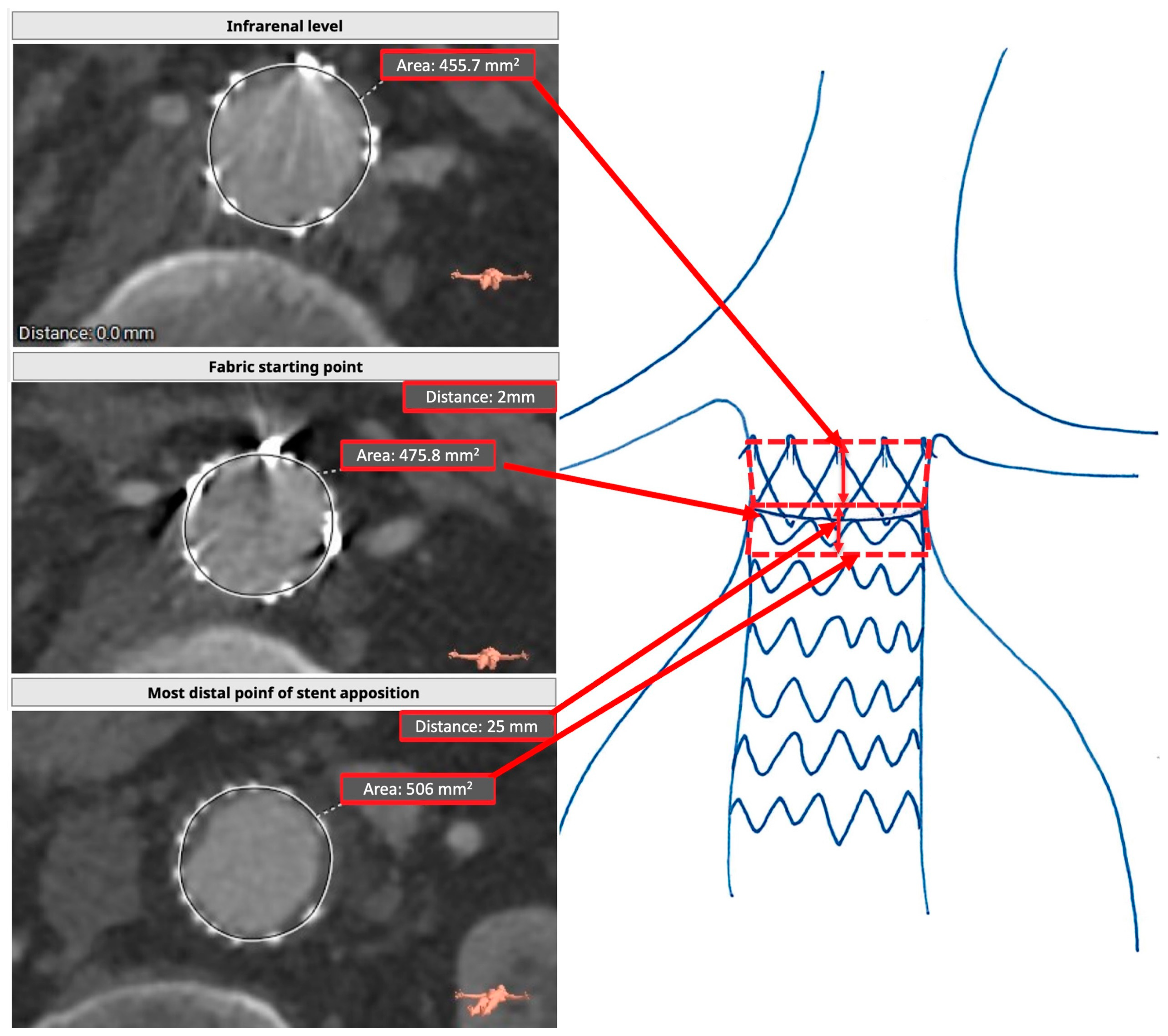 Jcm 14 01309 g002 Jcm 14 01309 g002