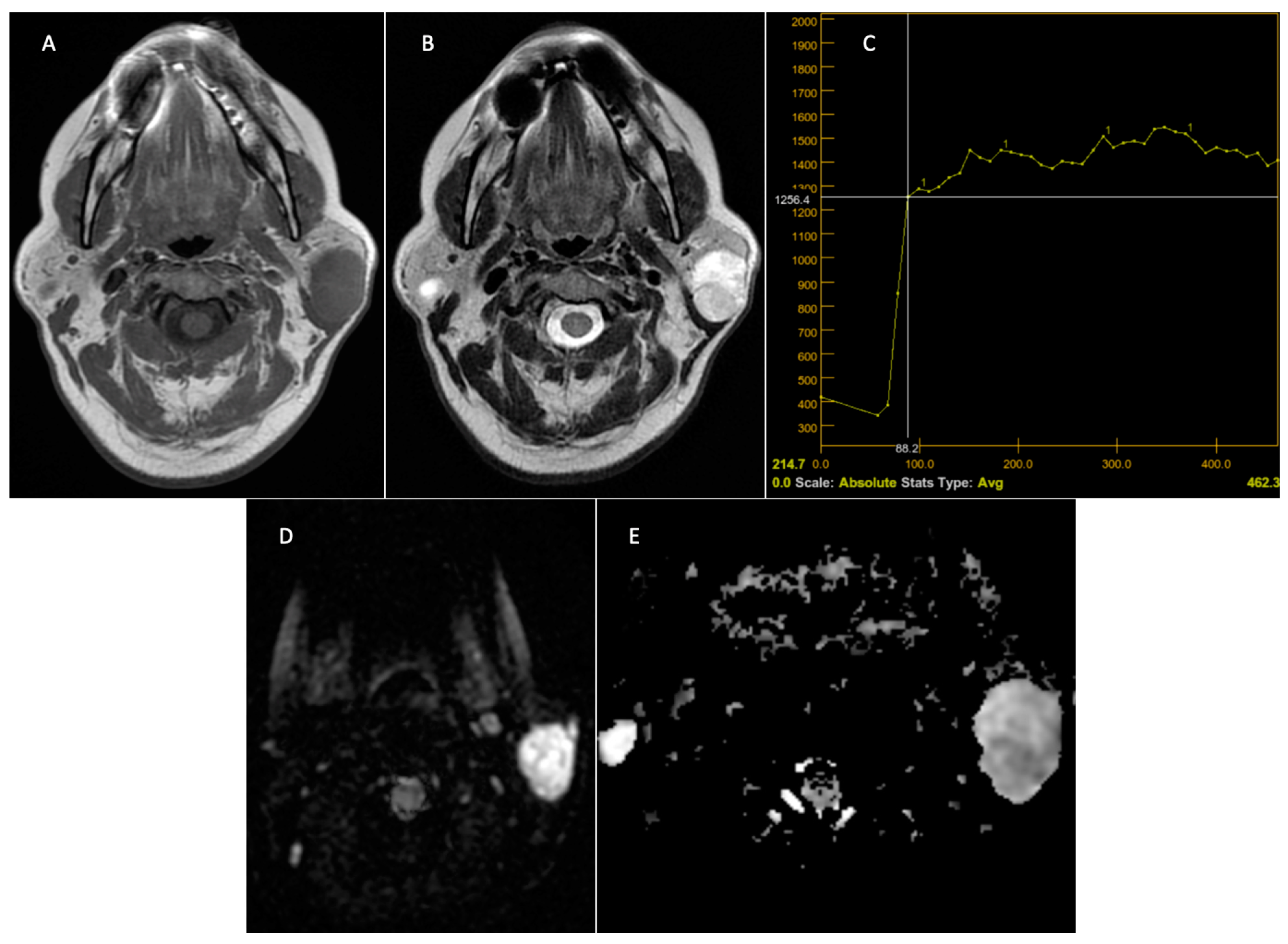 Jcm 14 01342 g005 Jcm 14 01342 g005