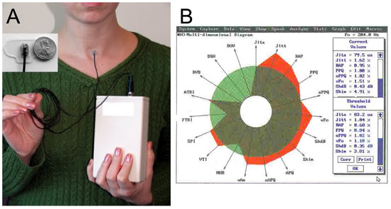 “Do You Hear What I Hear?” Speech and Voice Alterations in Hearing Loss ...
